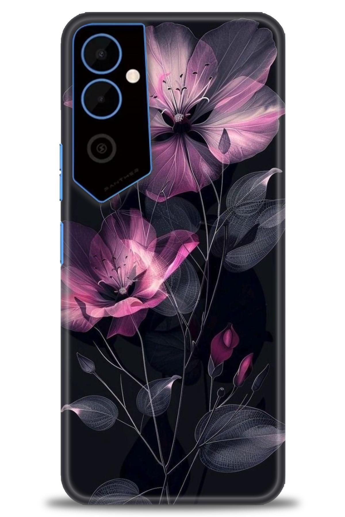 TECNO Pova 4 İle Uyumlu HD Baskılı Kılıf - ÖzelSeriTecno - 2522