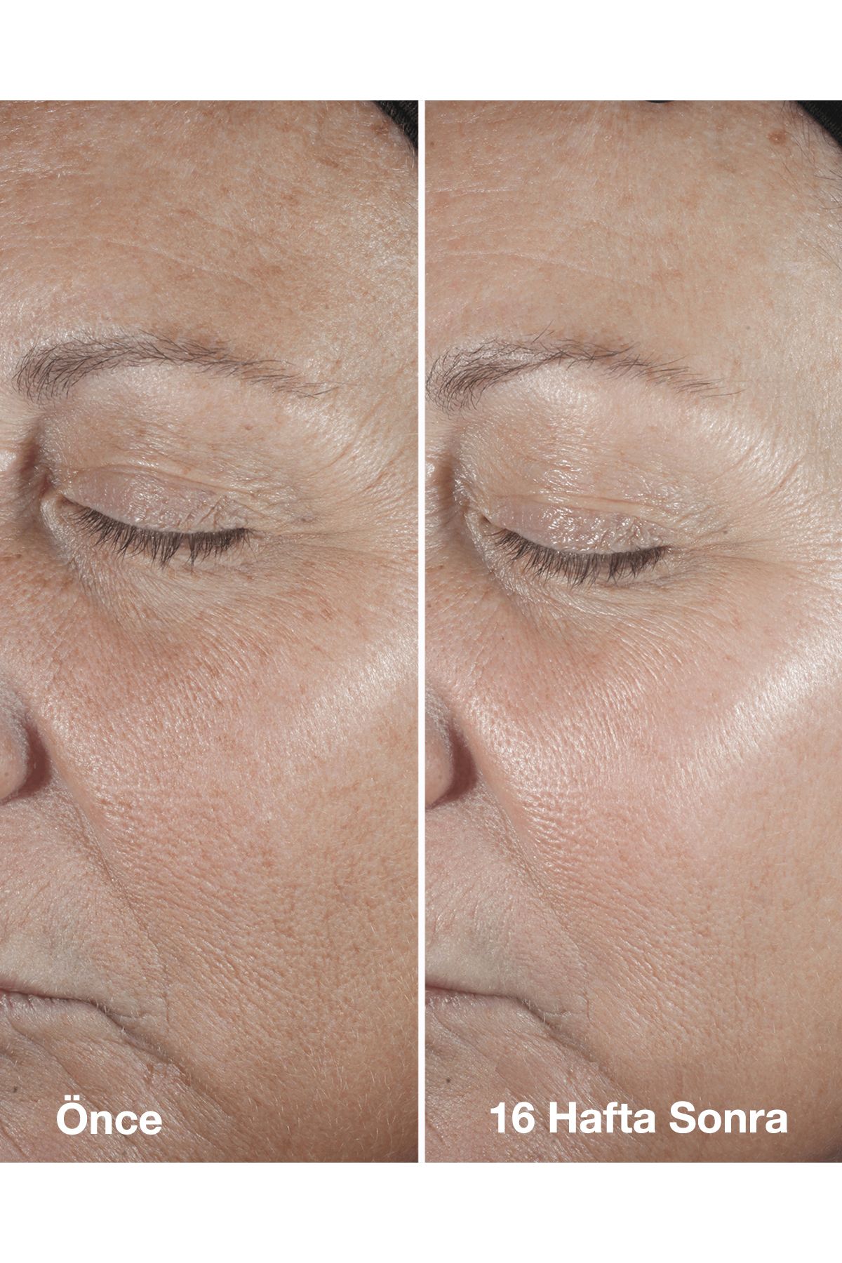 Clinique جوان کننده پوست هوشمند 75 میلی لیتری سرم ضد چین و چروک