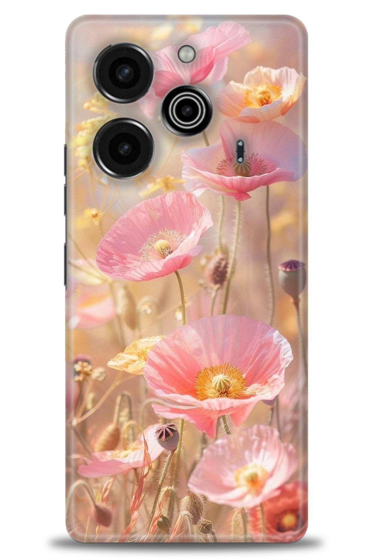 TECNO Pova 6 İle Uyumlu HD Baskılı Kılıf - ÖzelSeriTecno - 2788