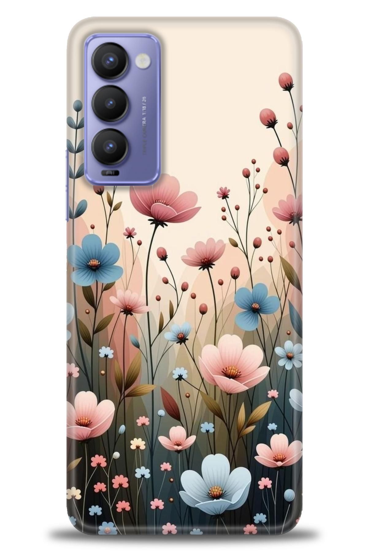 TECNO Camon 18 / 18P İle Uyumlu HD Baskılı Kılıf - ÖzelSeriTecno - 2977