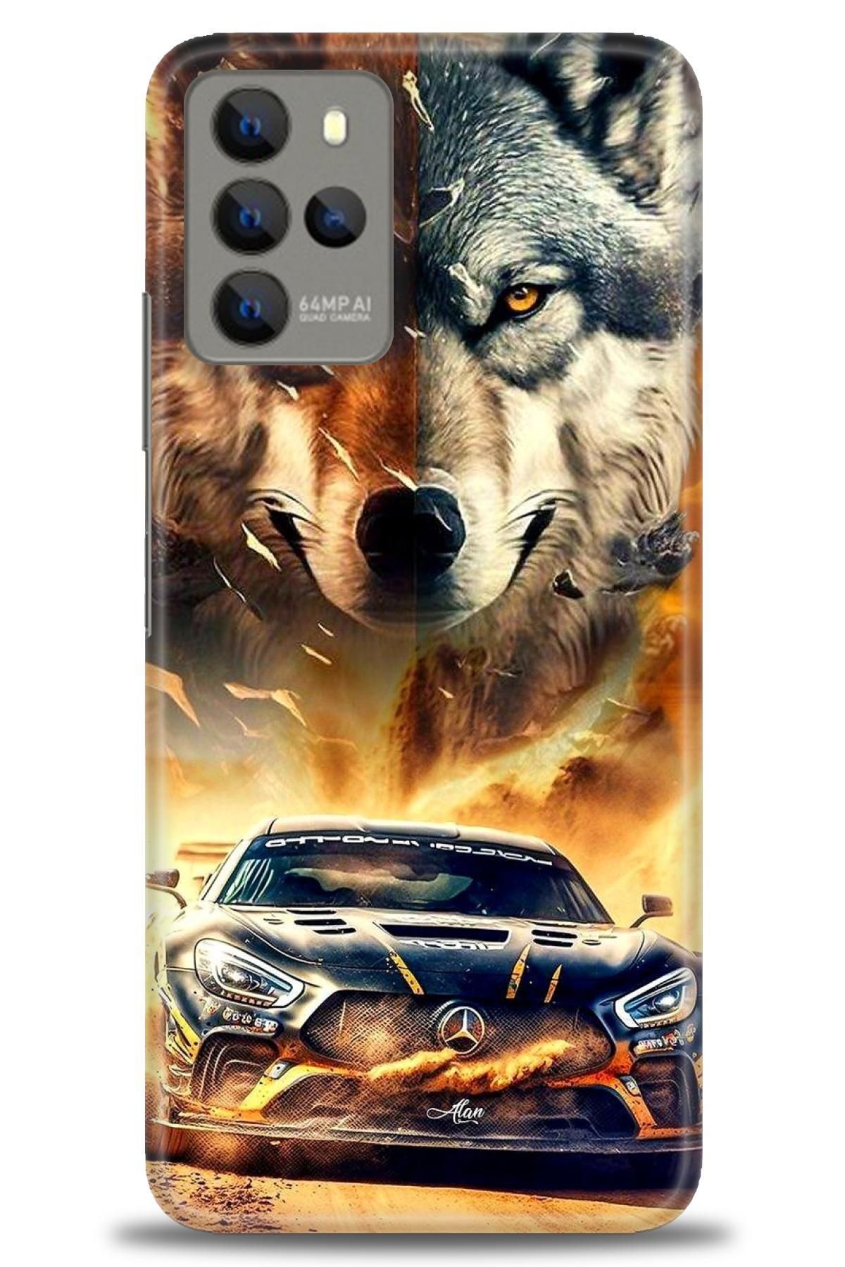 omix X700 İle Uyumlu HD Baskılı Kılıf - Karışık Seri - 851