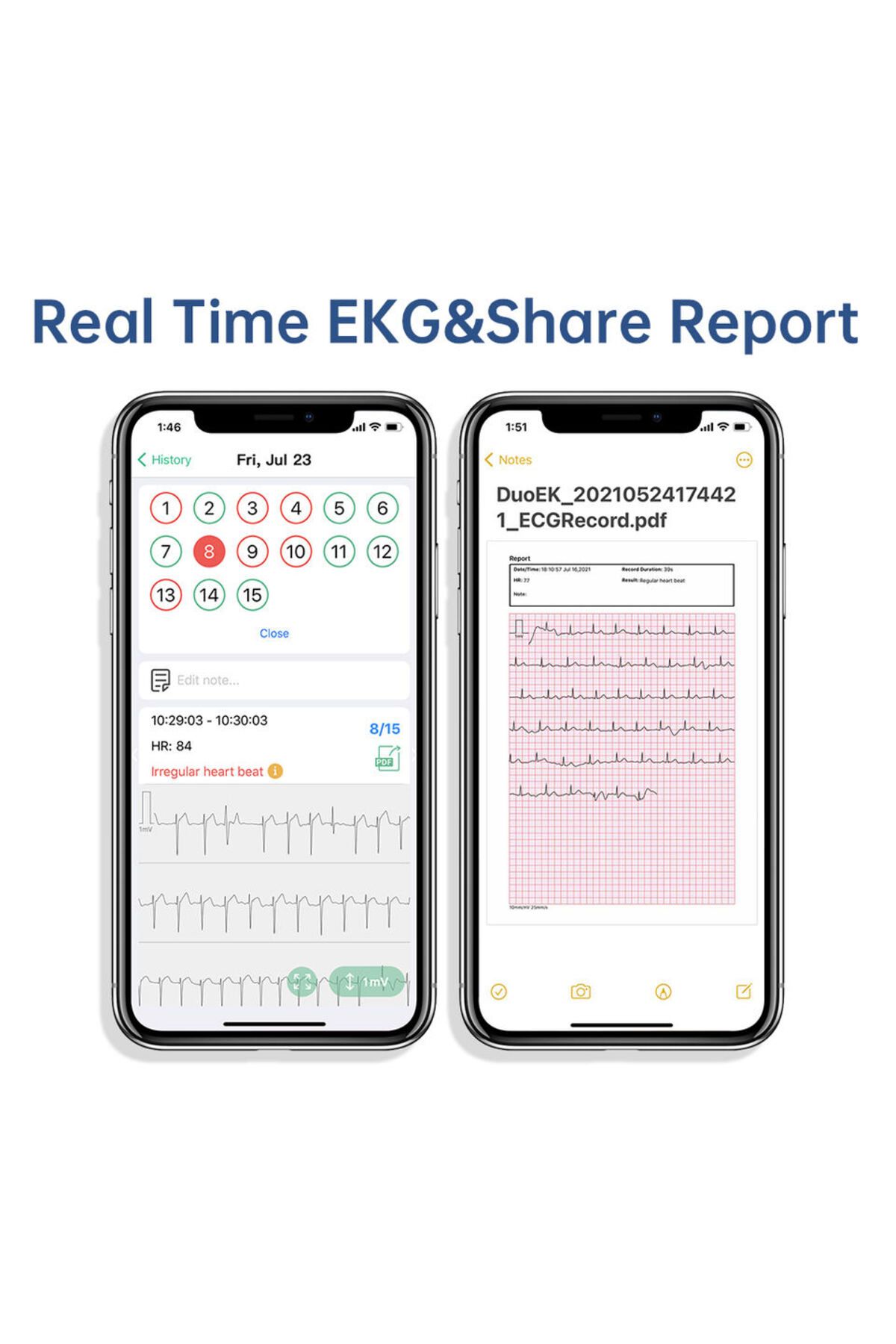 Choice-Pocket Ecg Monitoring Device With Oled Screen Bluetooth Ekg Monitor For Rhythm Waveform, Free App... 2
