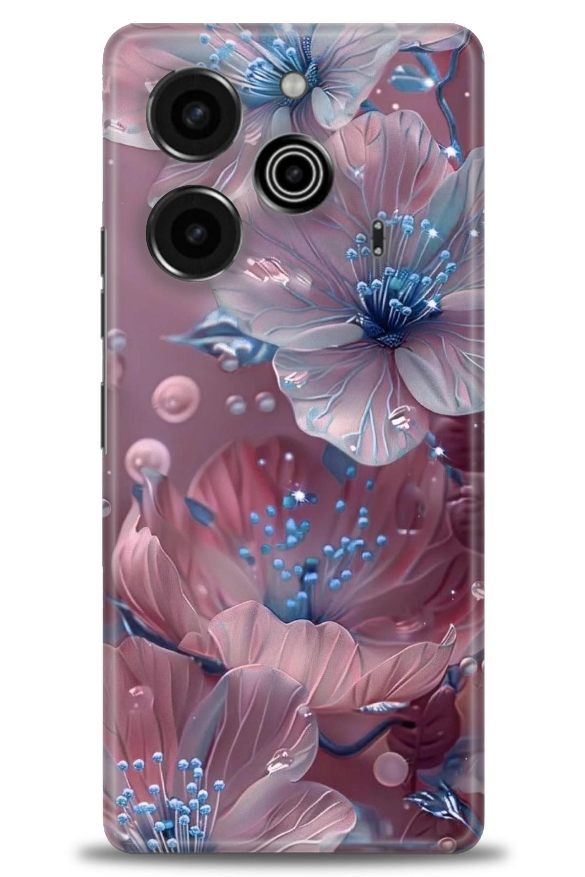 TECNO Pova 6 İle Uyumlu HD Baskılı Kılıf - ÖzelSeriTecno - 2304
