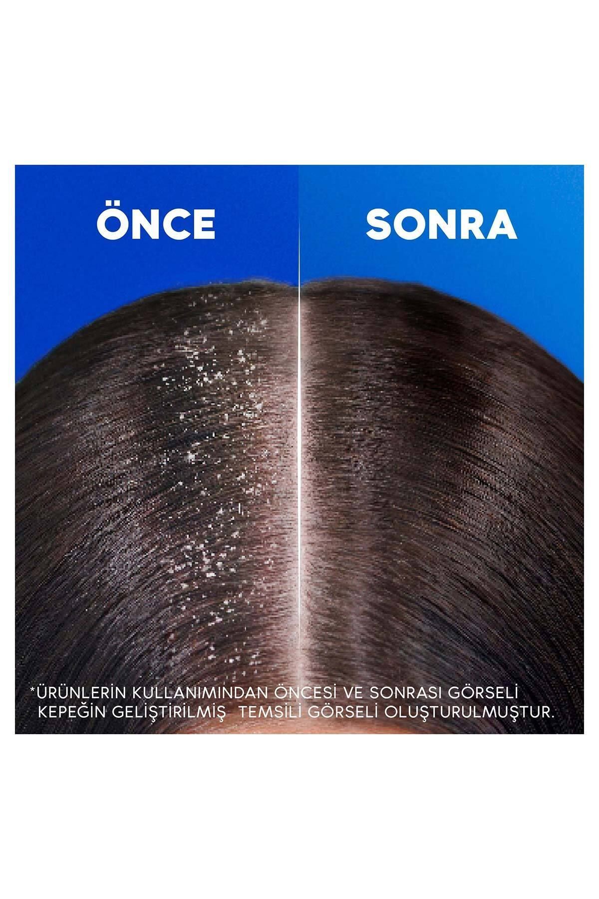 Head&Shoulders-Head & Shoulders 330 ml Shampoo 2-1 Silky Softness 6