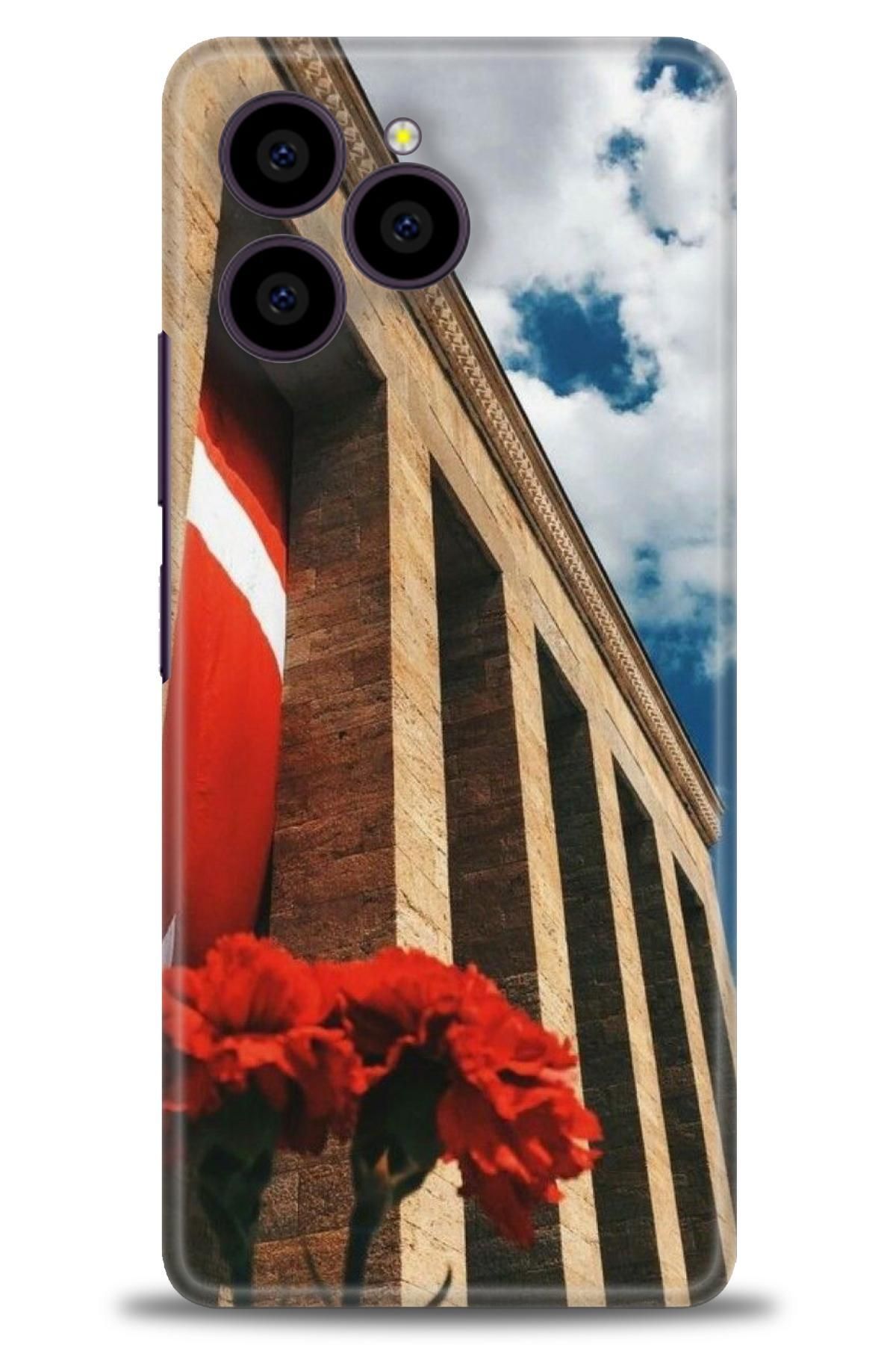 omix X6 İle Uyumlu HD Baskılı Kılıf - Karışık Seri - 465