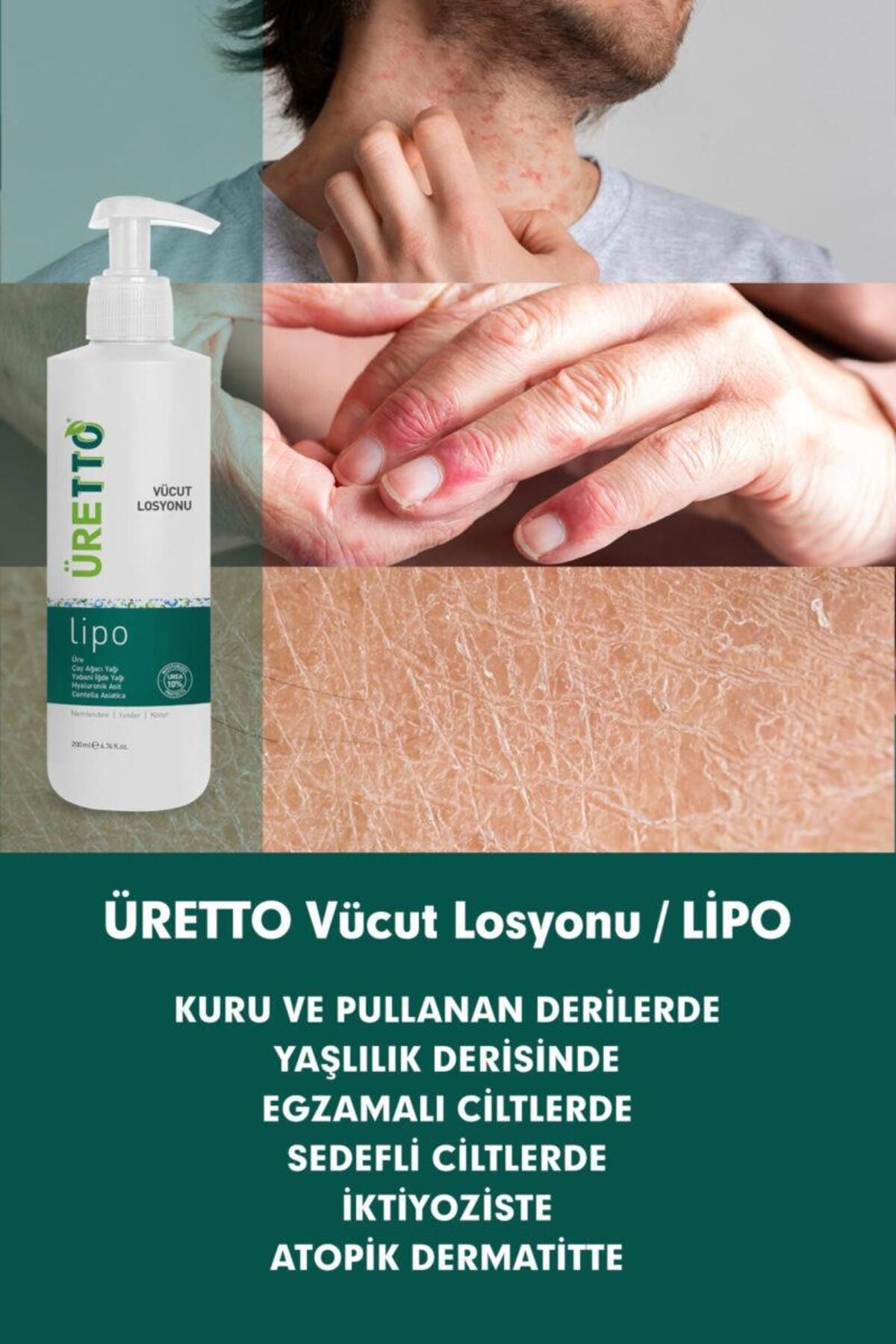 کرم بدن لوسیون URETTO LIPO 200 میل Tto
