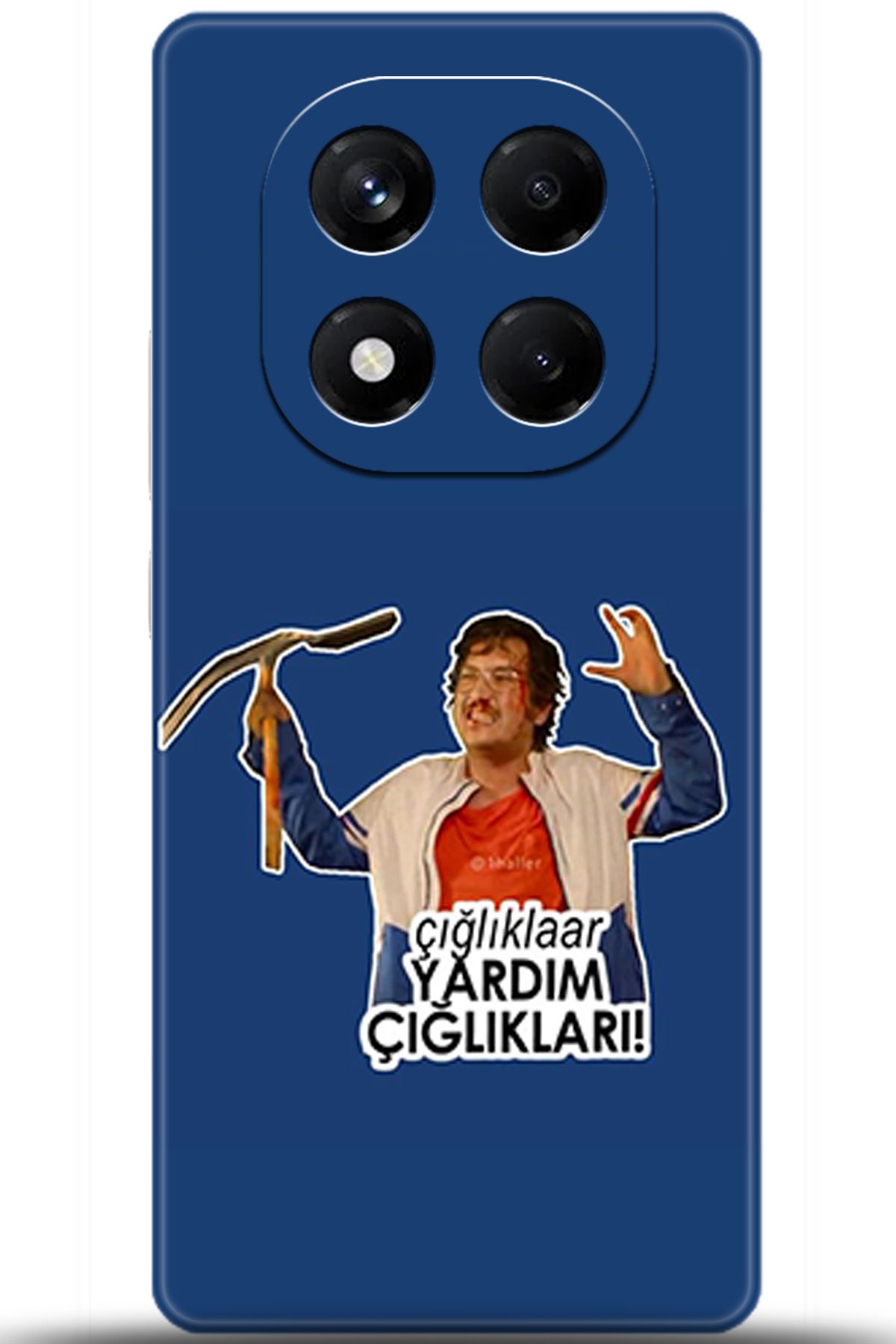 Noprin Xiaomi Redmi Note 14 Pro Kılıf HD Baskılı Kılıf - Loving You Series 5157