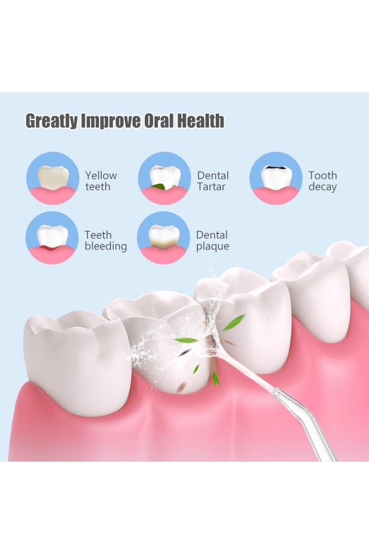 valkyrie-Portable Dental Denture Care and Oral Shower with Rechargeable UV Light 5