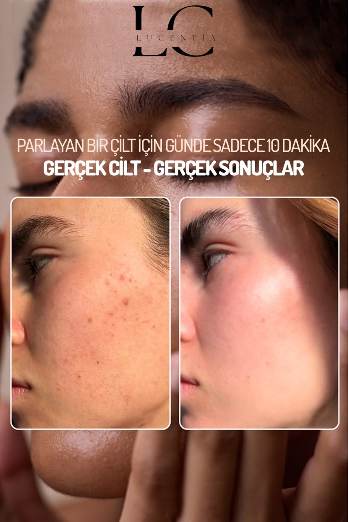 LUCENTİA-Anti-Blackhead Facial Cleansing Sebium for Combination, Oily and Prone Skin 5