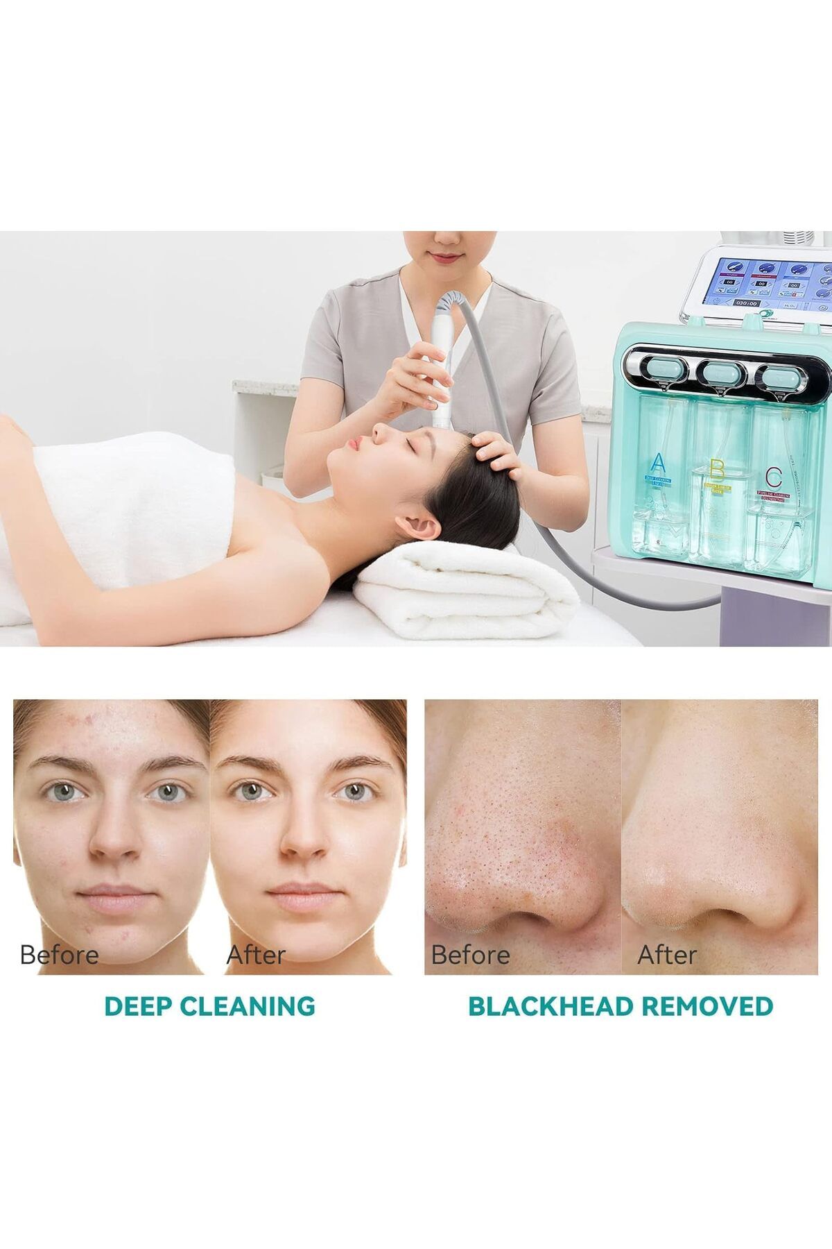LA PERLA TECH-Professional 7-in-1 Facial Treatment Machine with LED Mask, Touch Screen Display 2