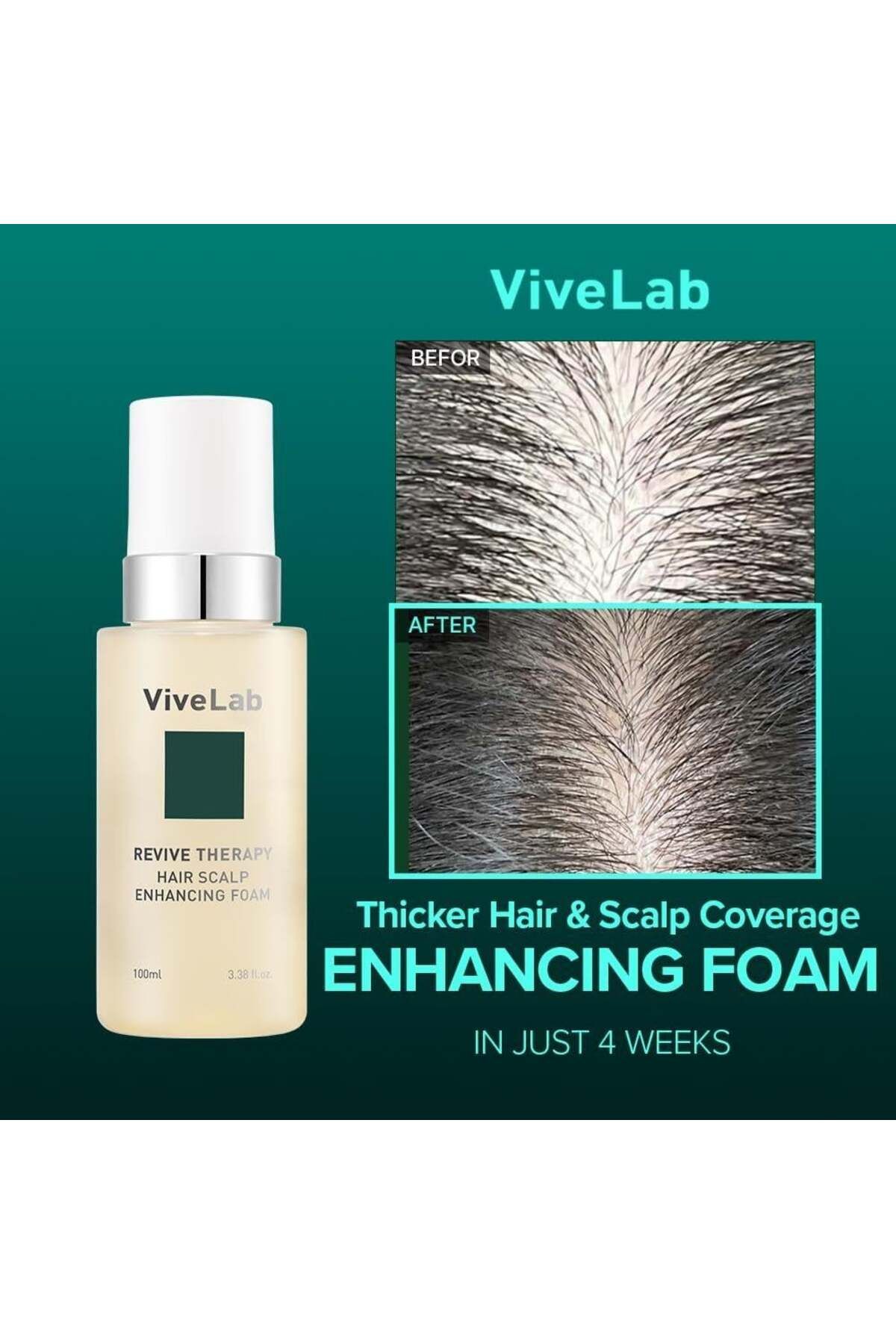 ViveLab-Vive Lab Revive Therapy Hair Scalp Enhancing Foam Contains 11 Patented Ingrediented 100 ml 4