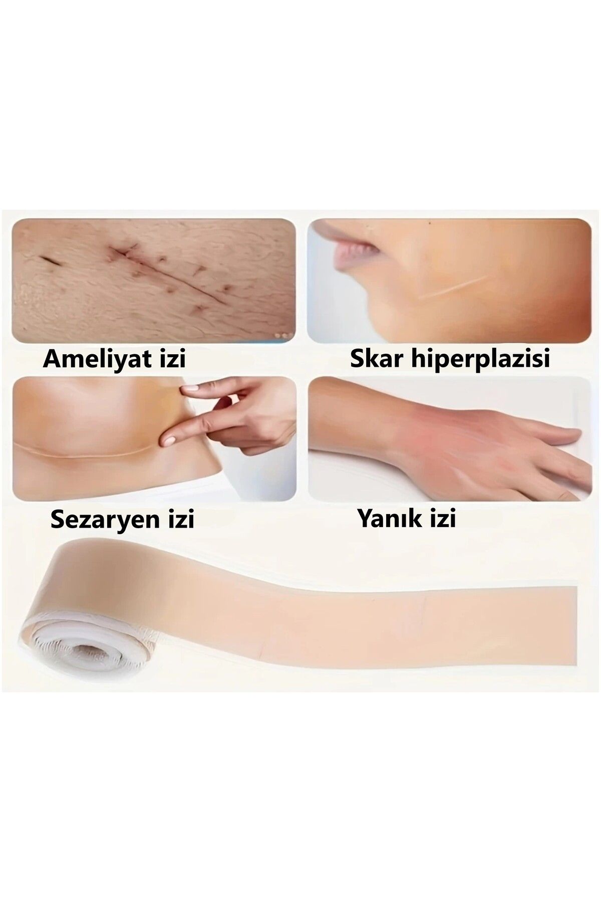 antiscar ameliyat izi