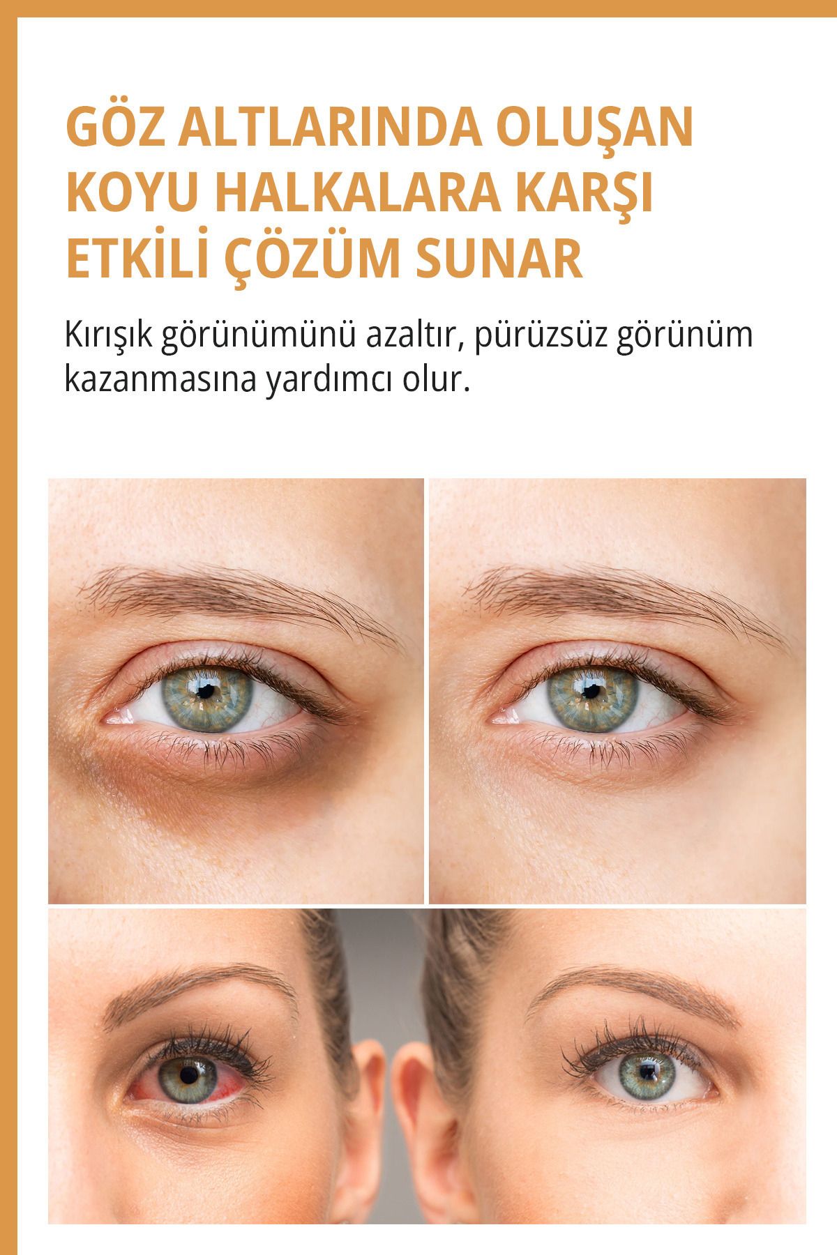 Göz Altı Ve Çevresi Bakım Kremi 100 ml