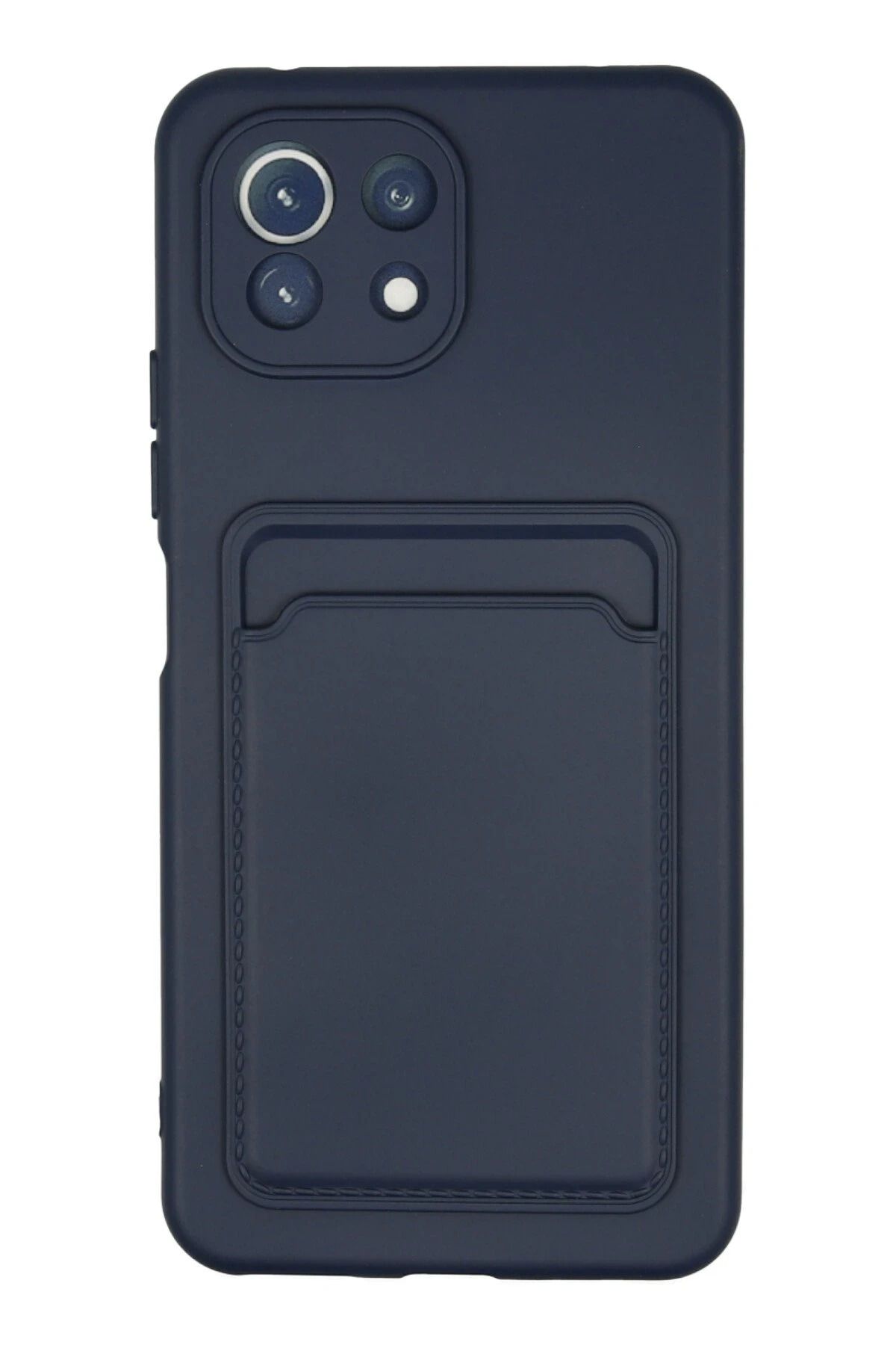 NewFace Xiaomi Mi 11 Kılıf Kelvin Kartvizitli Silikon - Lacivert FERRG