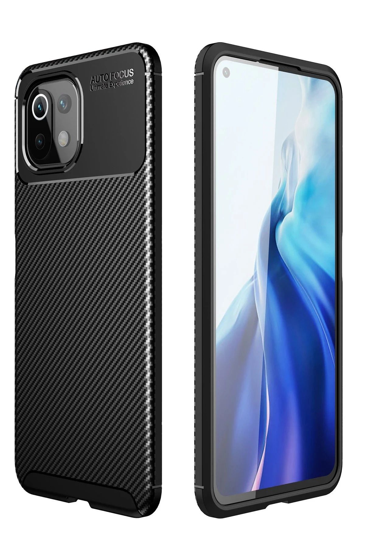 NewFace Xiaomi Mİ 11 Lite Kılıf Auto Focus Karbon Kapak - Siyah BSTMY