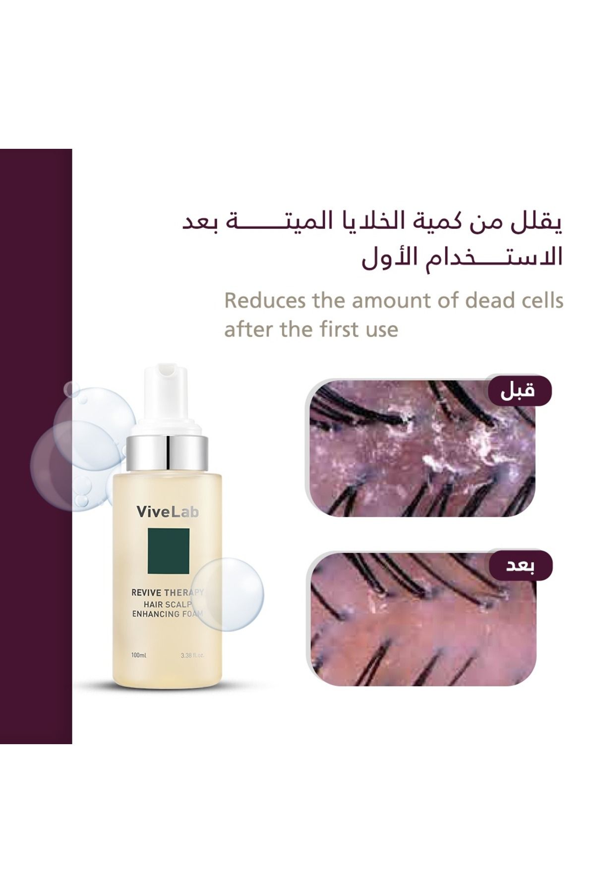 ViveLab-Vive Lab Revive Therapy Hair Scalp Enhancing Foam Contains 11 Patented Ingrediented 100 ml 3