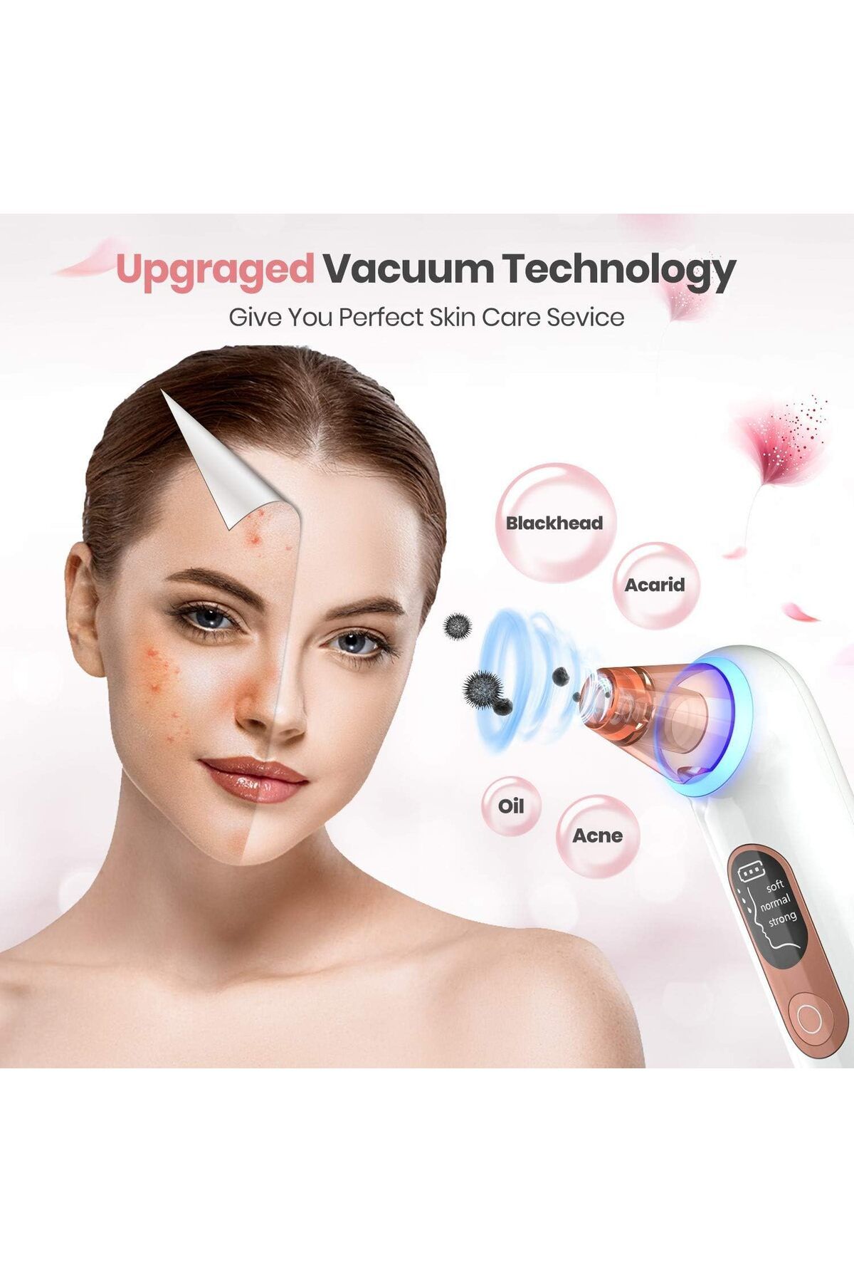 ARES-uFashion Blackhead Remover | 4 Replaceable probes to cleaning | Blue light technology | 3 Sucti 5