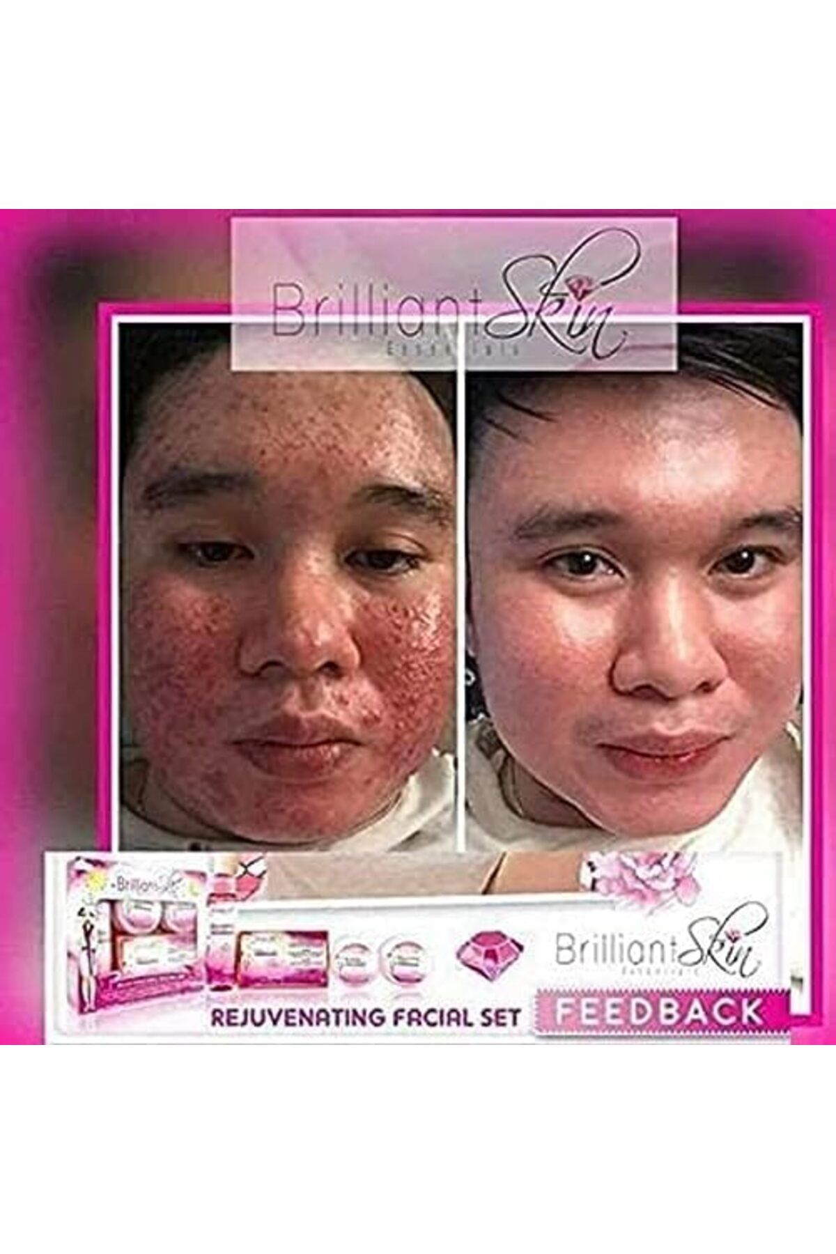 Brilliant-Skin Essentials Rejuvenating Whitening Facial Set 8