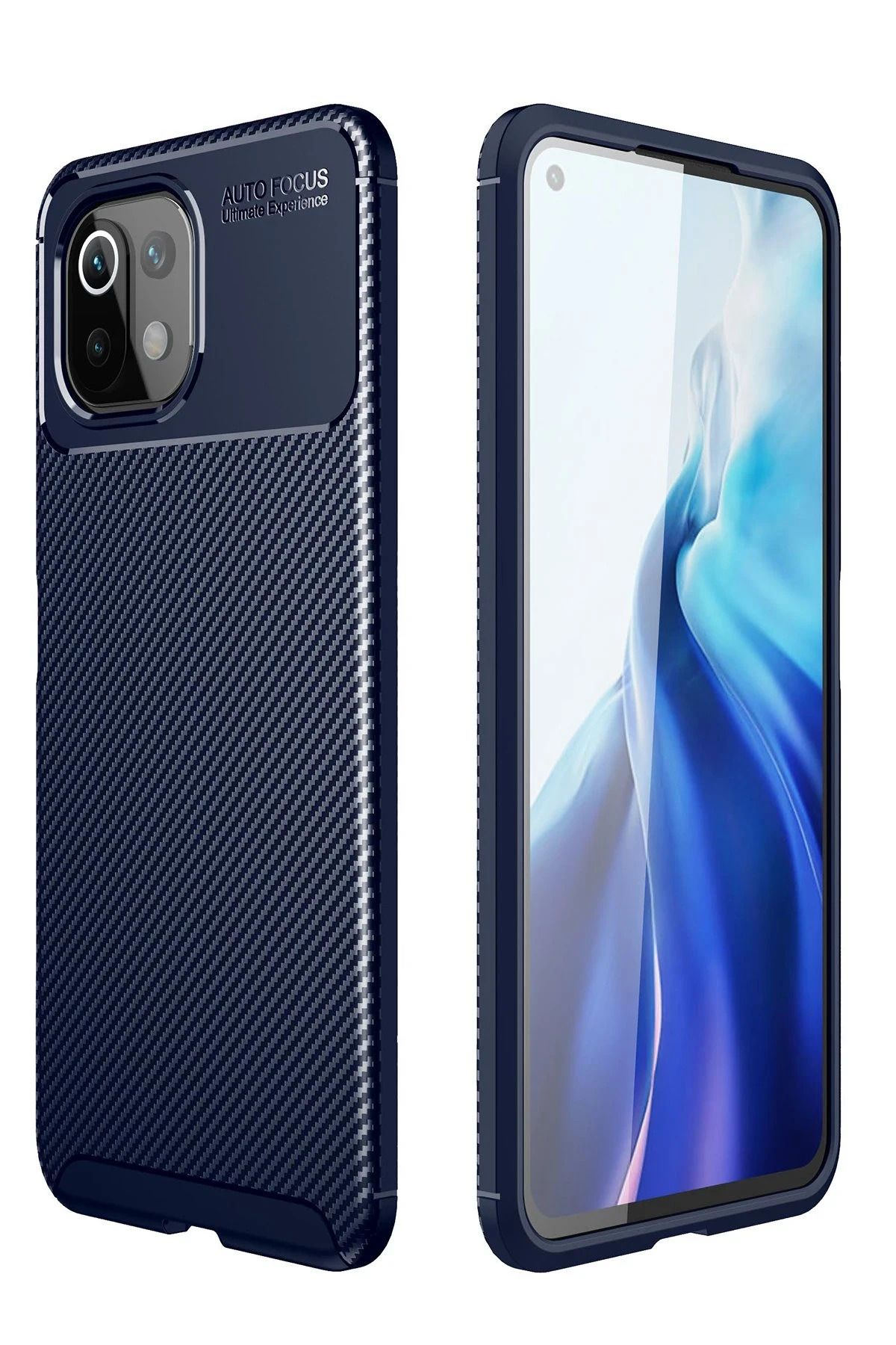 NewFace Xiaomi Mİ 11 Lite Kılıf Auto Focus Karbon Kapak - Lacivert BSTMY
