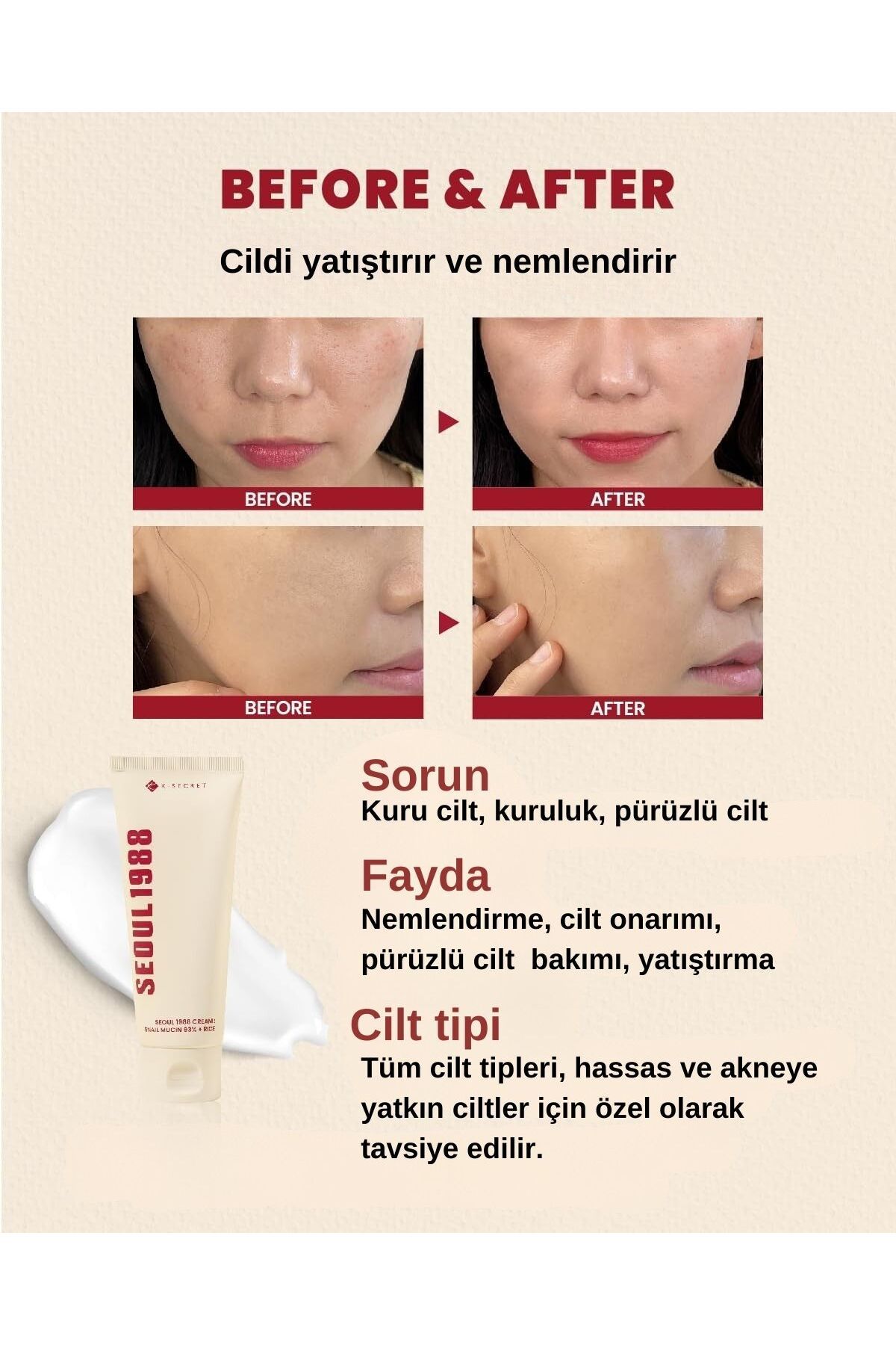 کرم صورت سئول 1988: مخترع حلزون 93 ٪ 100ML MUCIN و RICE ESSENCE. KSECRET