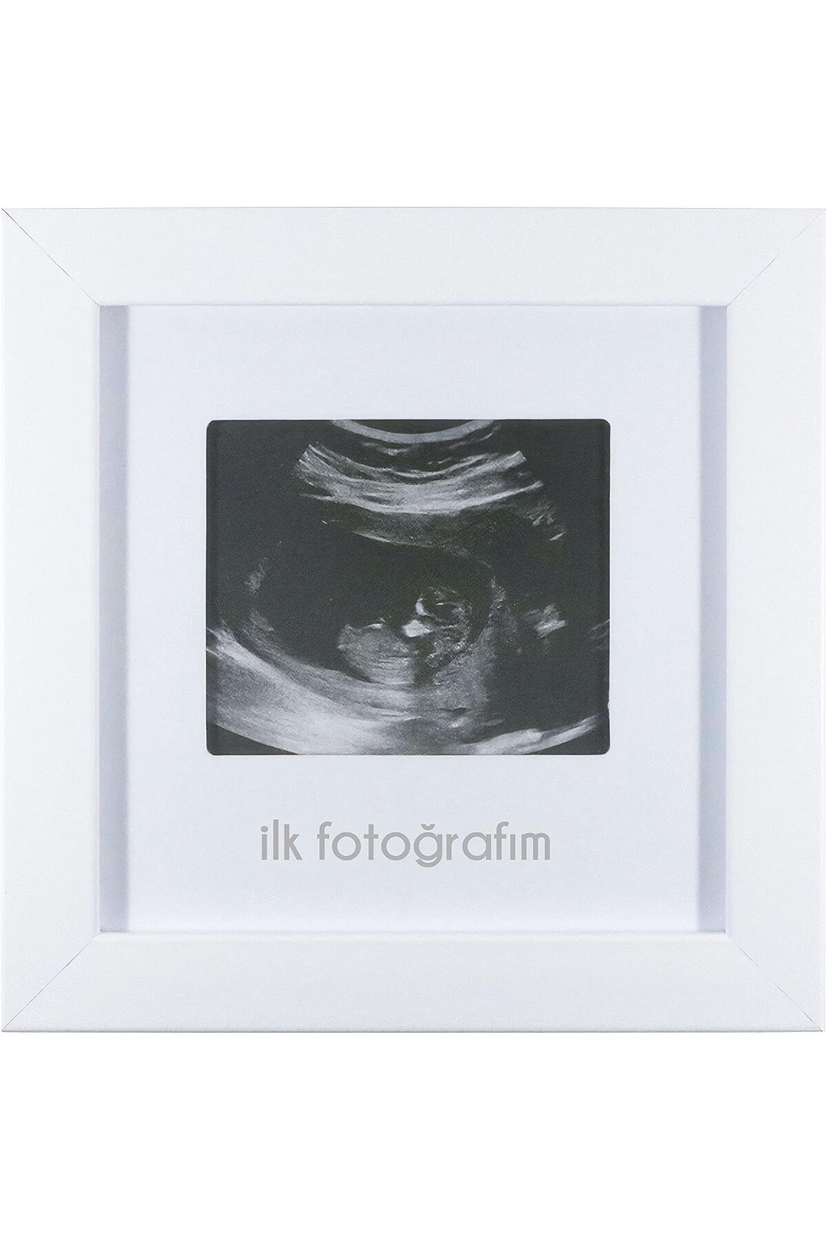 Mu Art Ahşap Mrt İlk Fotoğrafım Bebek Ultrason Çerçevesi - Bebek Odası Resim Anı Çerçevesi Art 871301