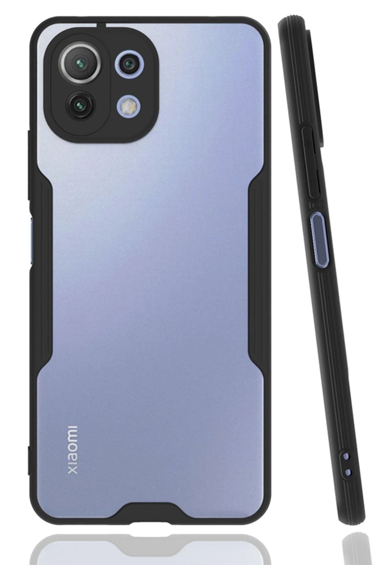 NewFace Xiaomi Mİ 11 Lite Kılıf Platin Silikon - Siyah JOJUA