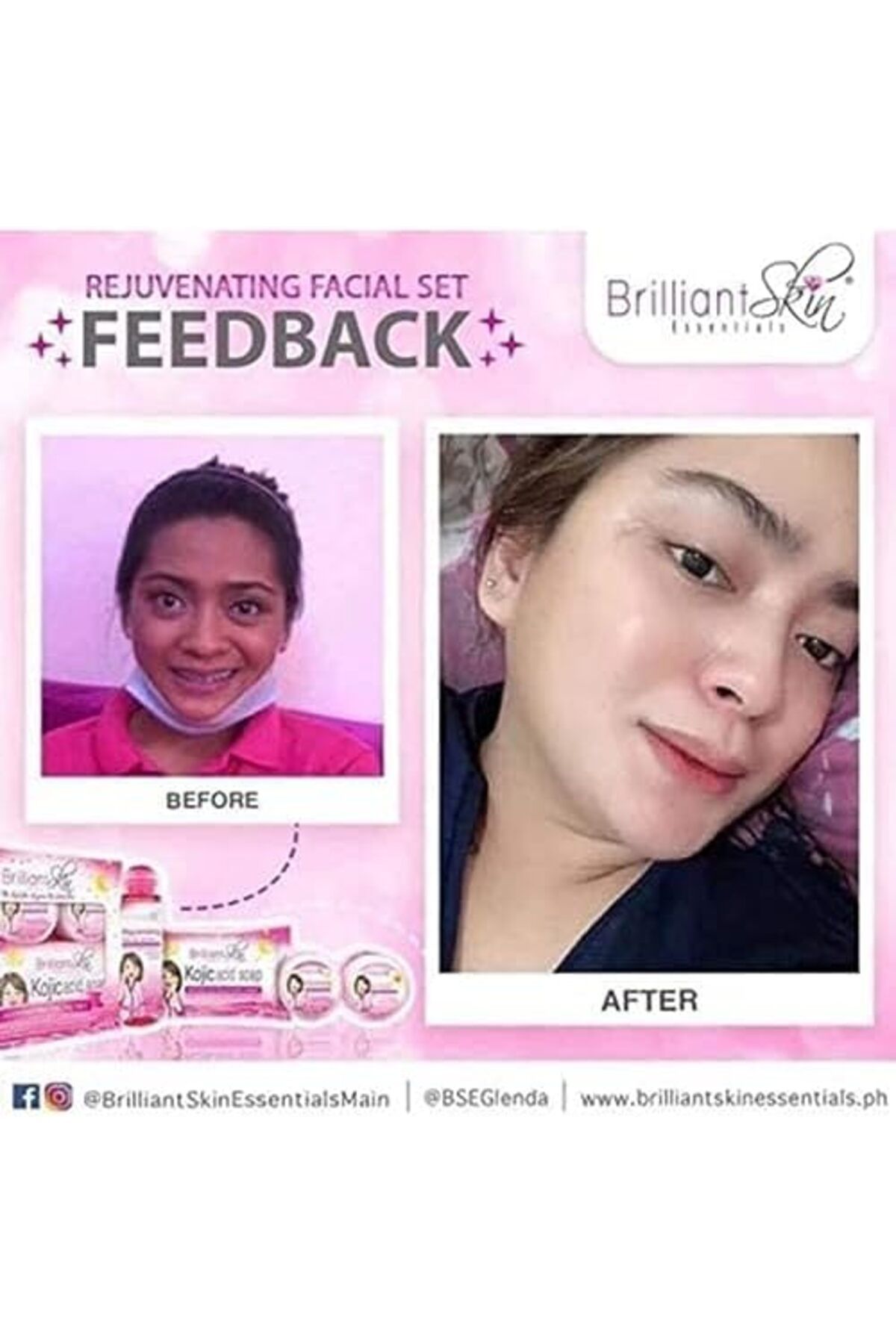 Brilliant-Skin Essentials Rejuvenating Whitening Facial Set 4
