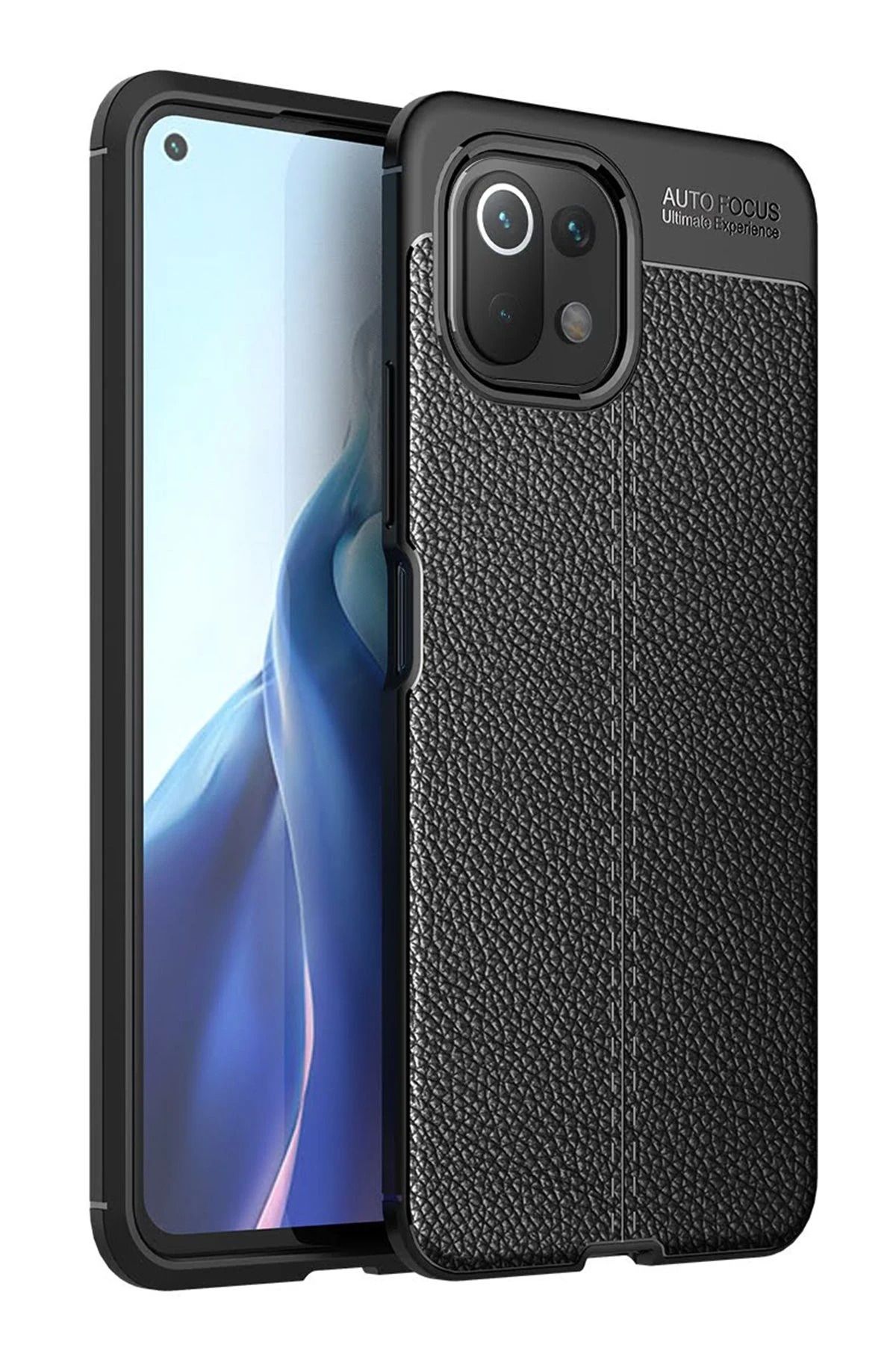 NewFace Xiaomi Mİ 11 Lite Kılıf Auto Focus Kapak - Siyah HNZRN