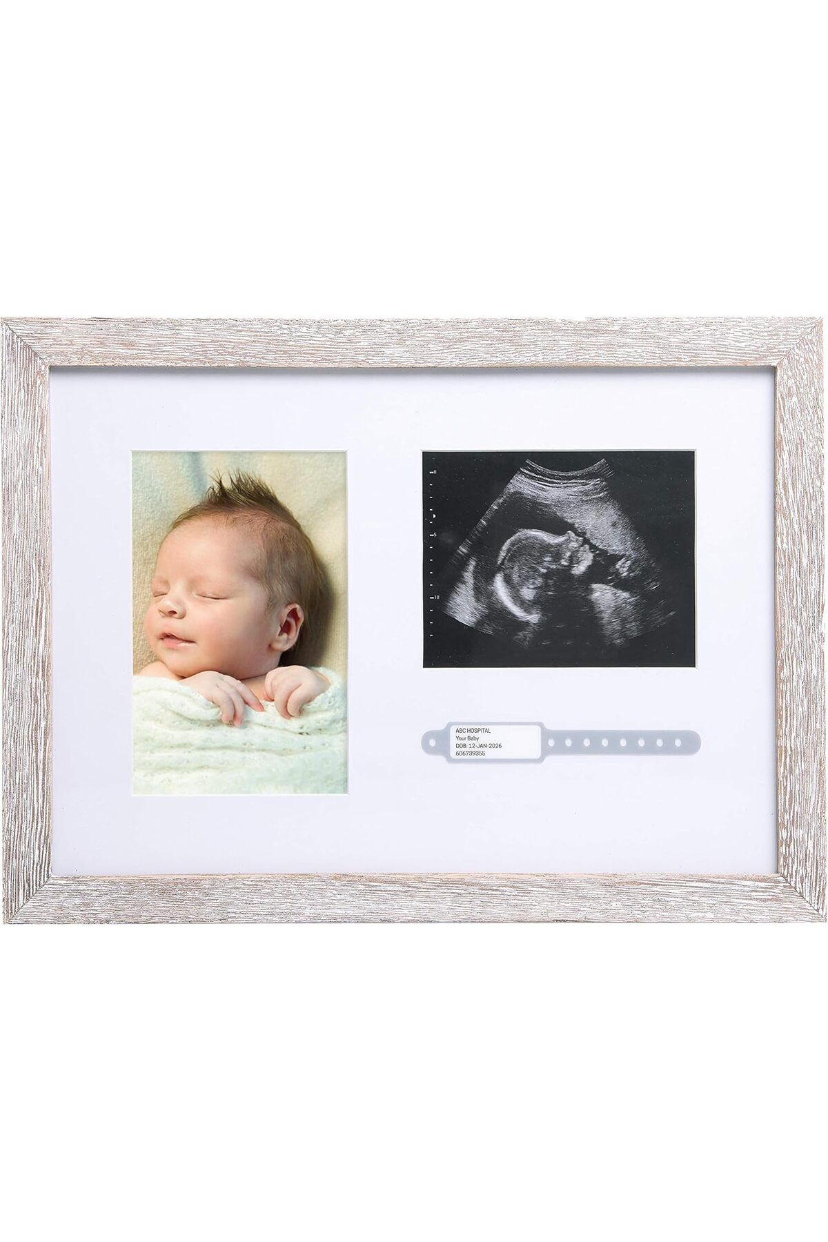 STOREMAX Bileklik Kimlik Fotoğraf ve Sonogram Çerçevesi, Bebek Ultrasonik Fotoğraf Çerçevesi, Ru
