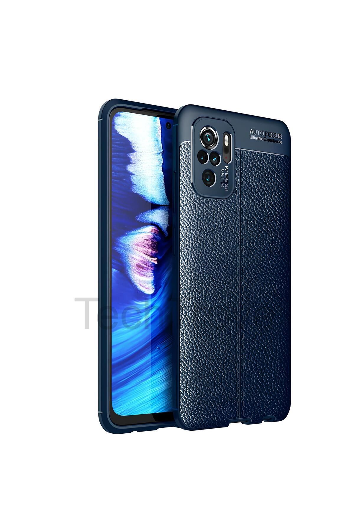 TechTrove Xiaomi Redmi Note 10 Kılıf Deri Extra Korumalı Slikon Kapak