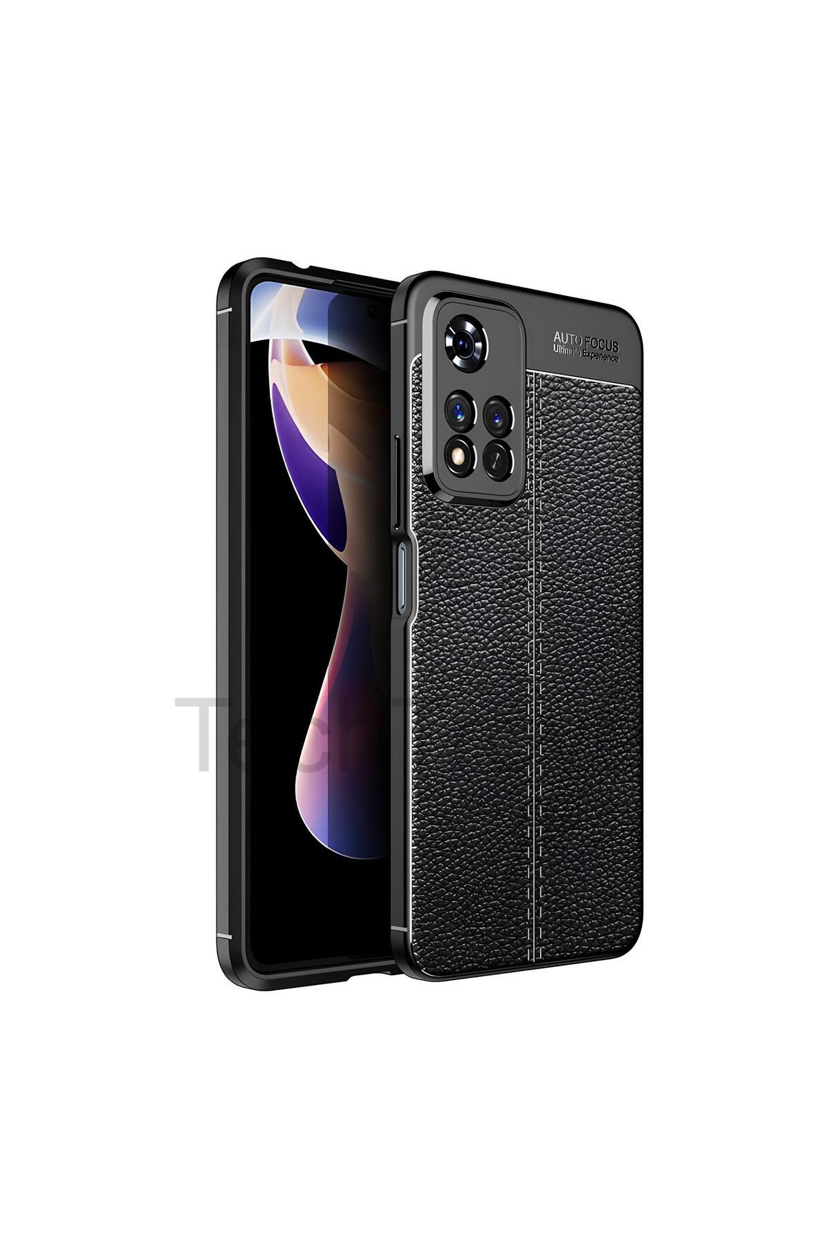TechTrove Xiaomi Redmi Note 11 Pro 5G Kılıf Deri Extra Korumalı Slikon Kapak