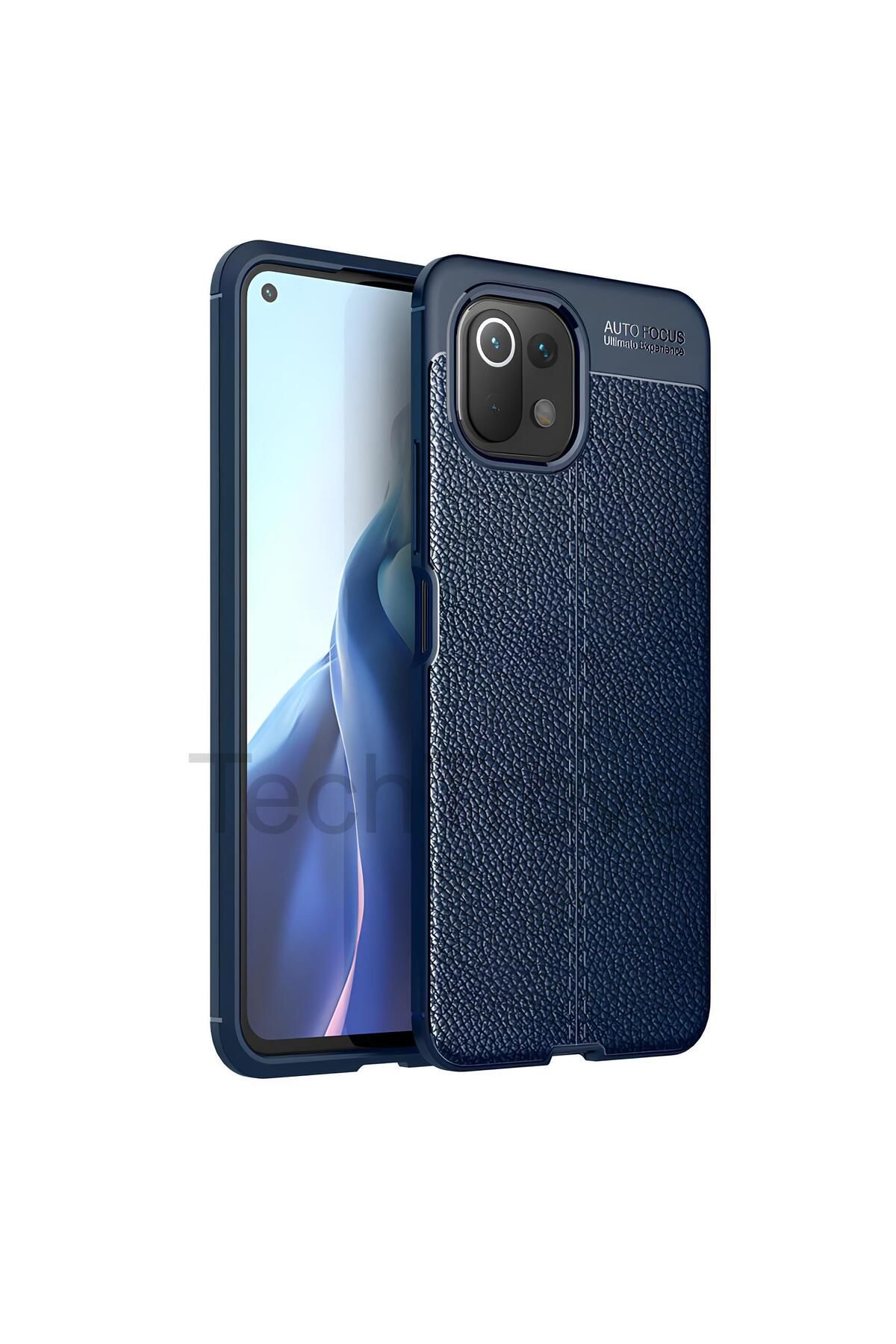 TechTrove Xiaomi Mi 11 Lite Kılıf Deri Extra Korumalı Slikon Kapak