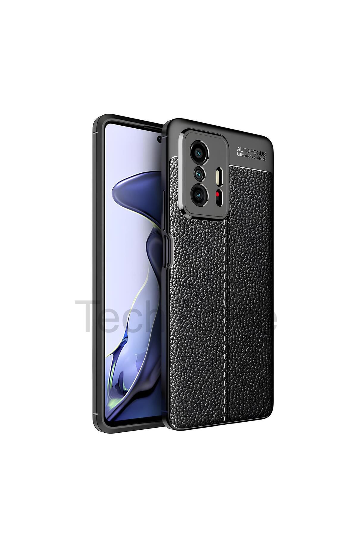 TechTrove Xiaomi Mi 11T Pro Kılıf Deri Extra Korumalı Slikon Kapak