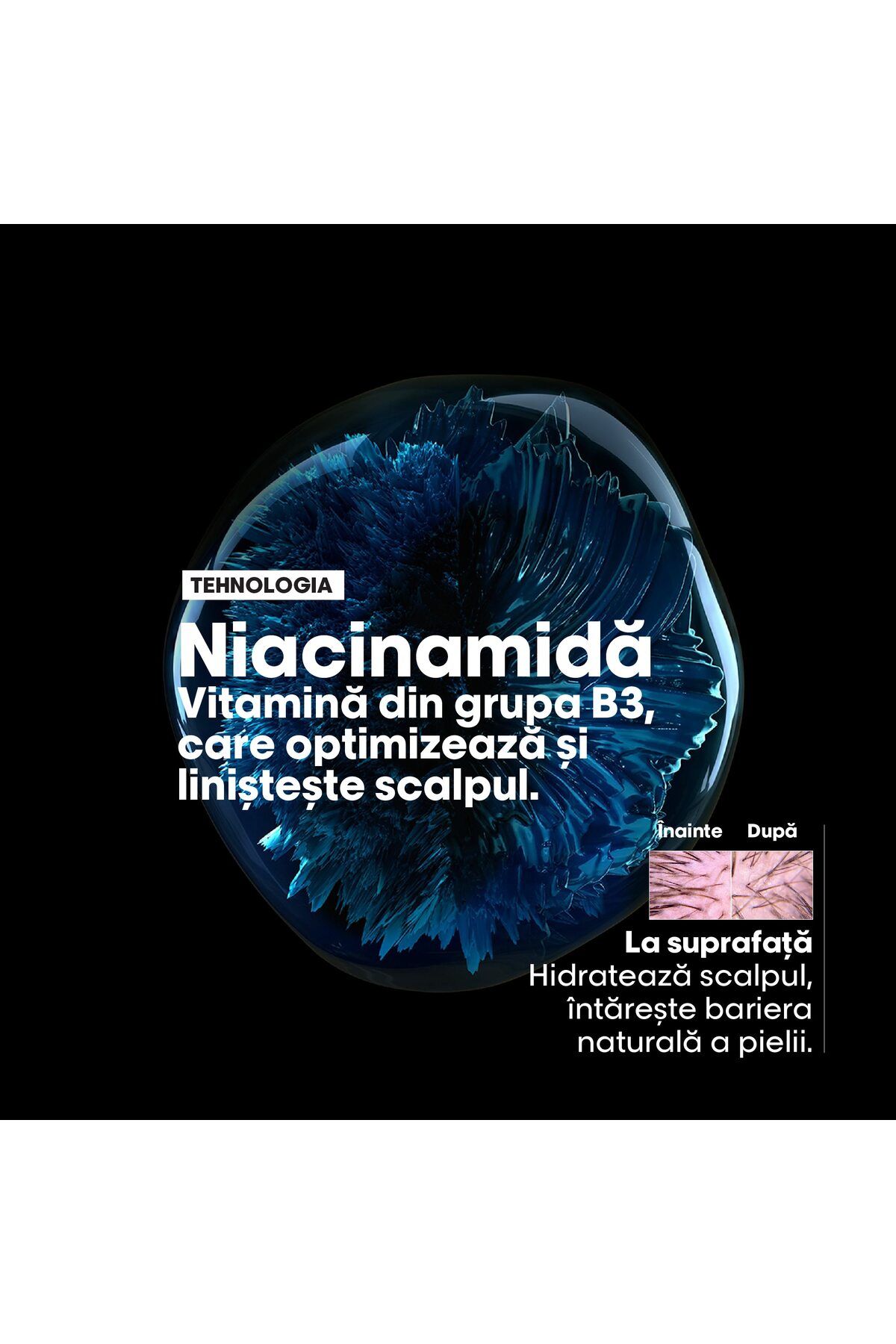 L'Oreal Paris-Sampon scalp sensibil 5