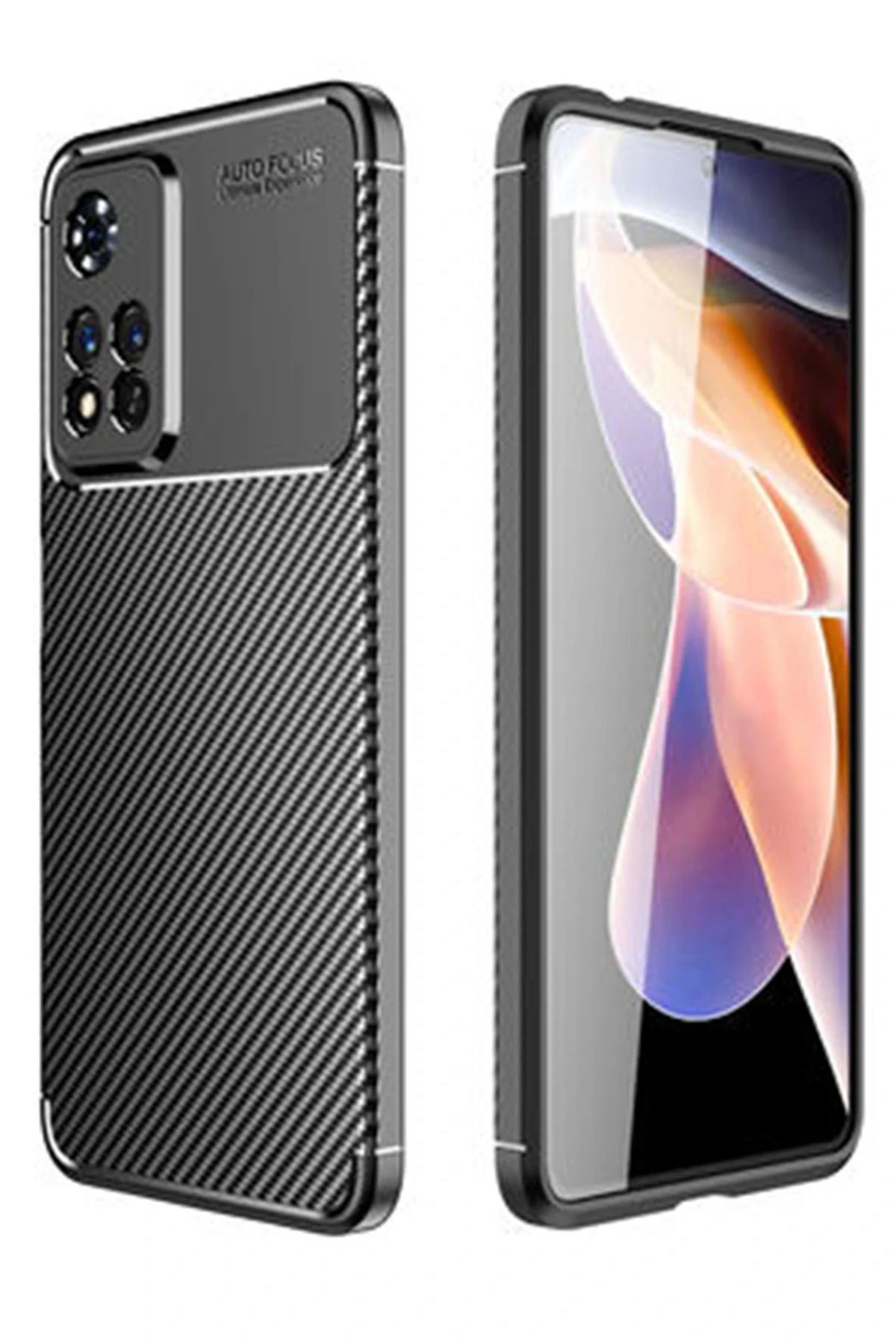 NewFace Xiaomi Redmi Note 11 Pro Plus 5G Kılıf Auto Focus Karbon Kapak - Siyah NRMSA