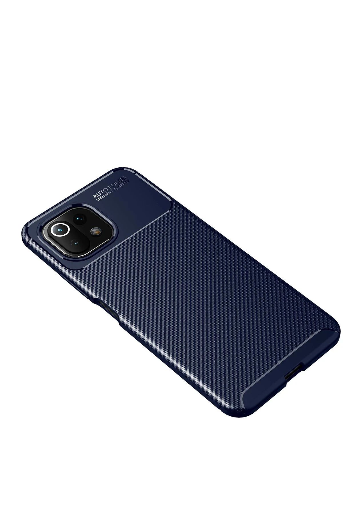 NewFace Xiaomi Mİ 11 Lite Kılıf Auto Focus Karbon Kapak - Lacivert SVLRS