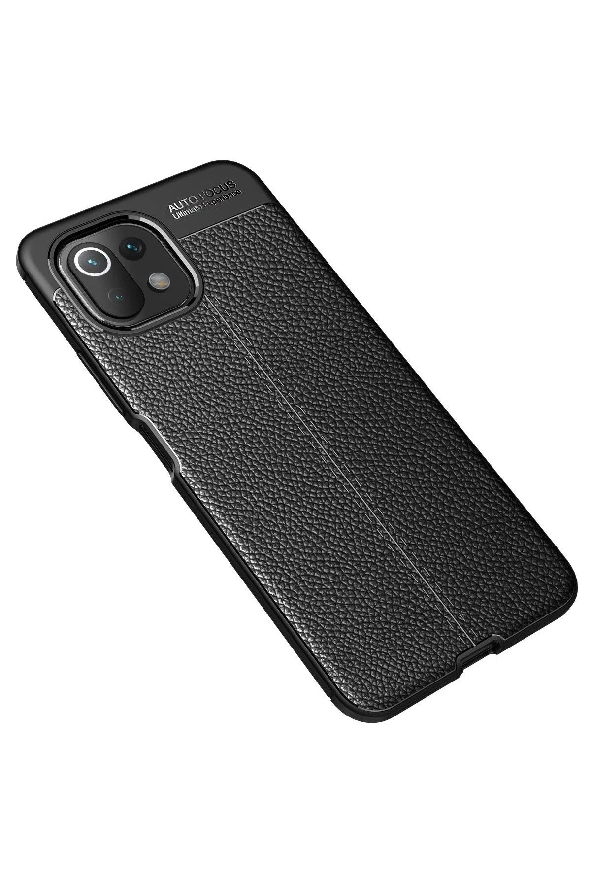 NewFace Xiaomi Mİ 11 Lite Kılıf Auto Focus Kapak - Siyah GLSTD