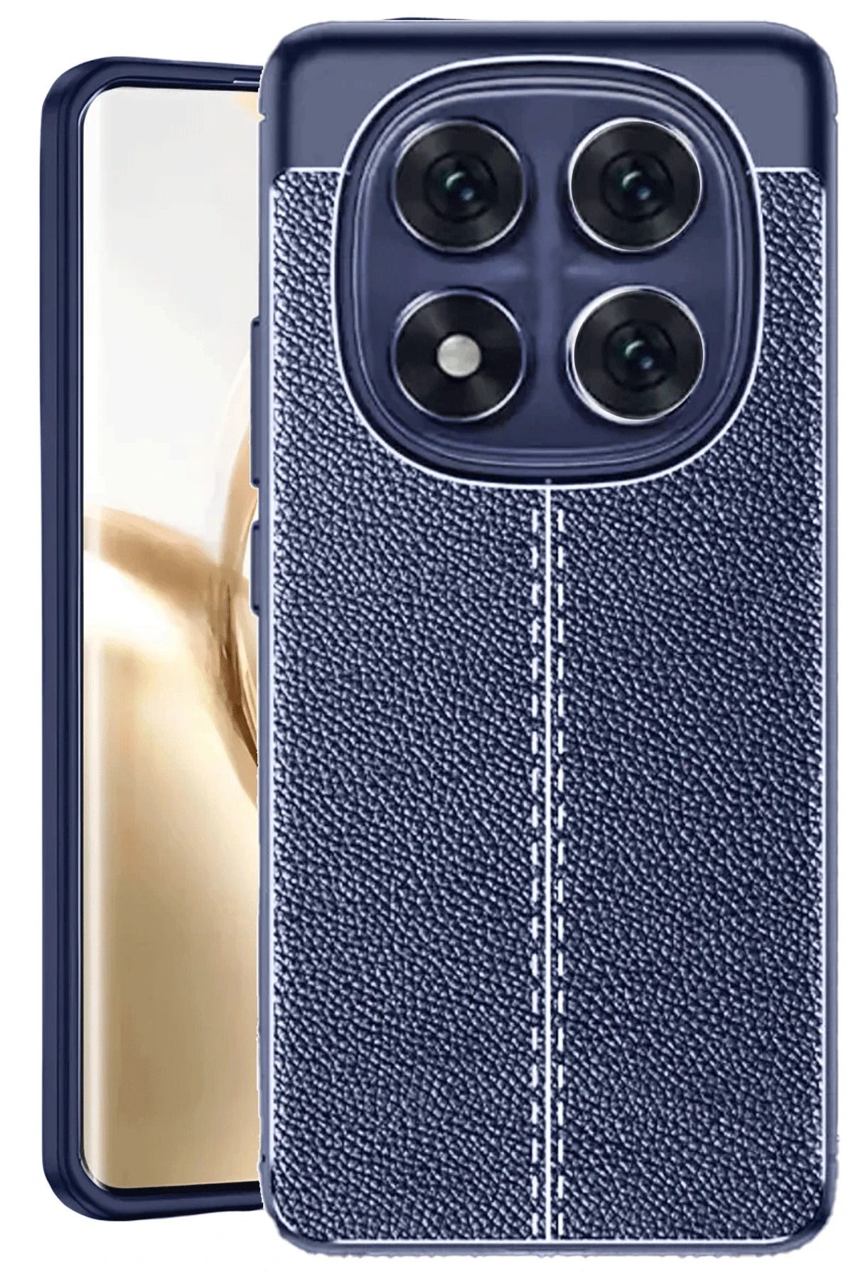 Posso Xiaomi Redmi Note 14 Pro 4G Kılıf Deri Dikiş Tasarım Ultra Dayanıklı Slim Fit Esnek Kapak