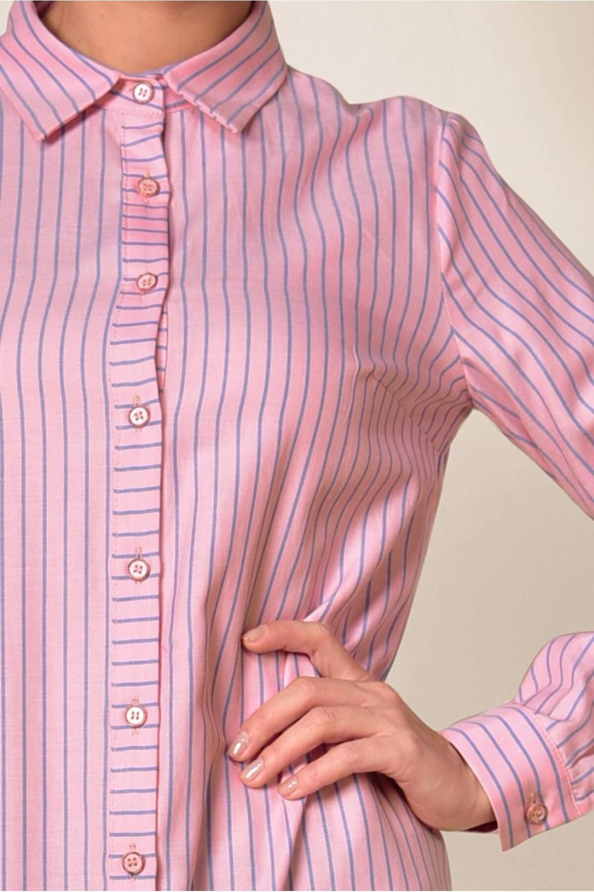 Alvina-4979 Model Buttoned Stripe Patterned Tunic 4