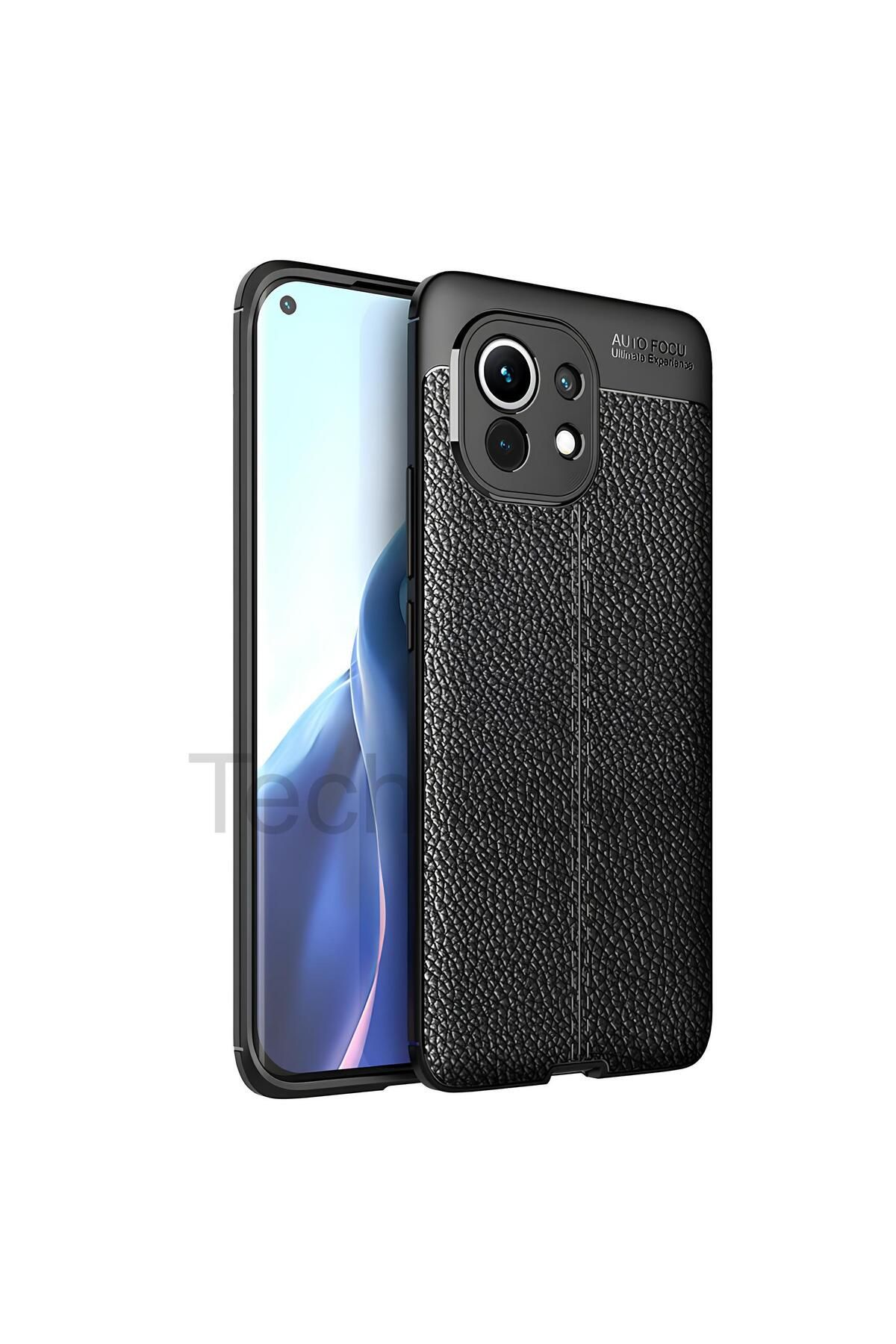 TechTrove Xiaomi Mi 11 Kılıf Deri Extra Korumalı Slikon Kapak