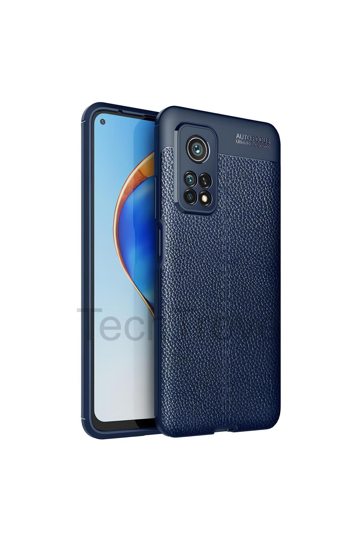 TechTrove Xiaomi Mi 10T Pro Kılıf Deri Extra Korumalı Slikon Kapak