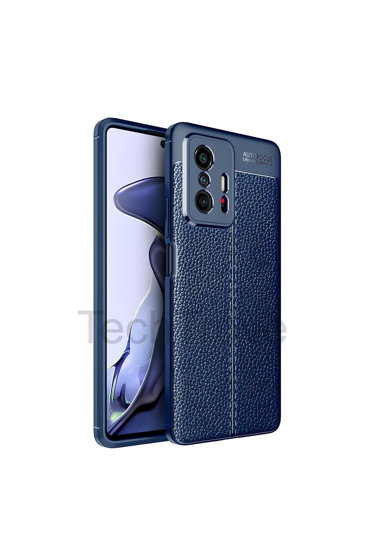 TechTrove Xiaomi Mi 11T Kılıf Deri Extra Korumalı Slikon Kapak
