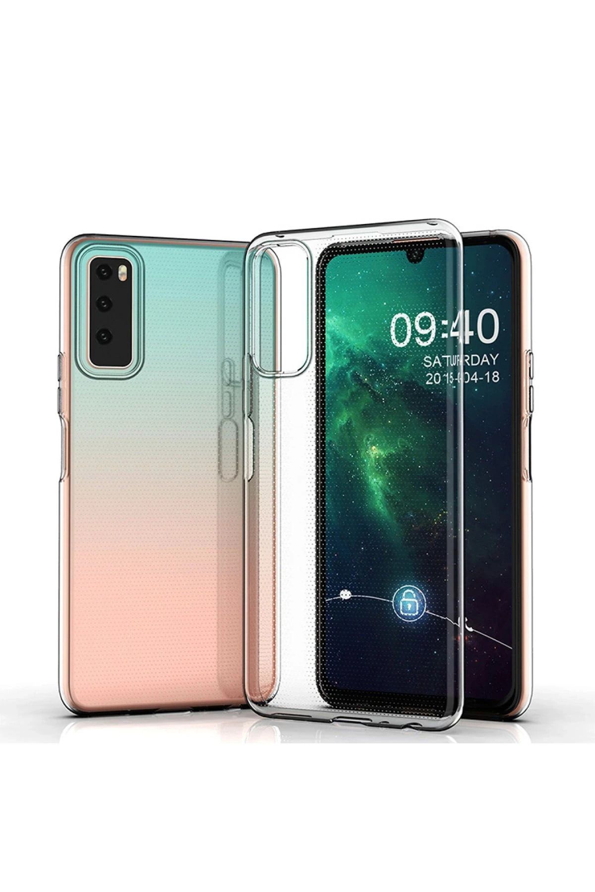 NewFace Vivo Y53S Kılıf Lüx Şeffaf Silikon ALMLA