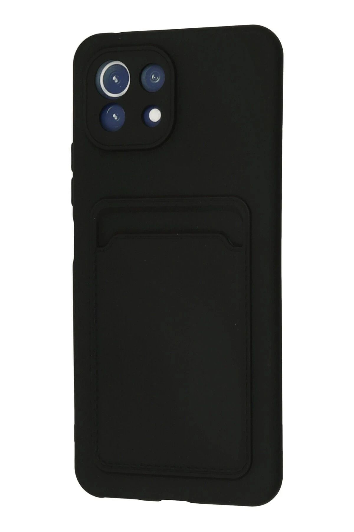 NewFace Xiaomi Mi 11 Kılıf Kelvin Kartvizitli Silikon - Siyah NRMSA