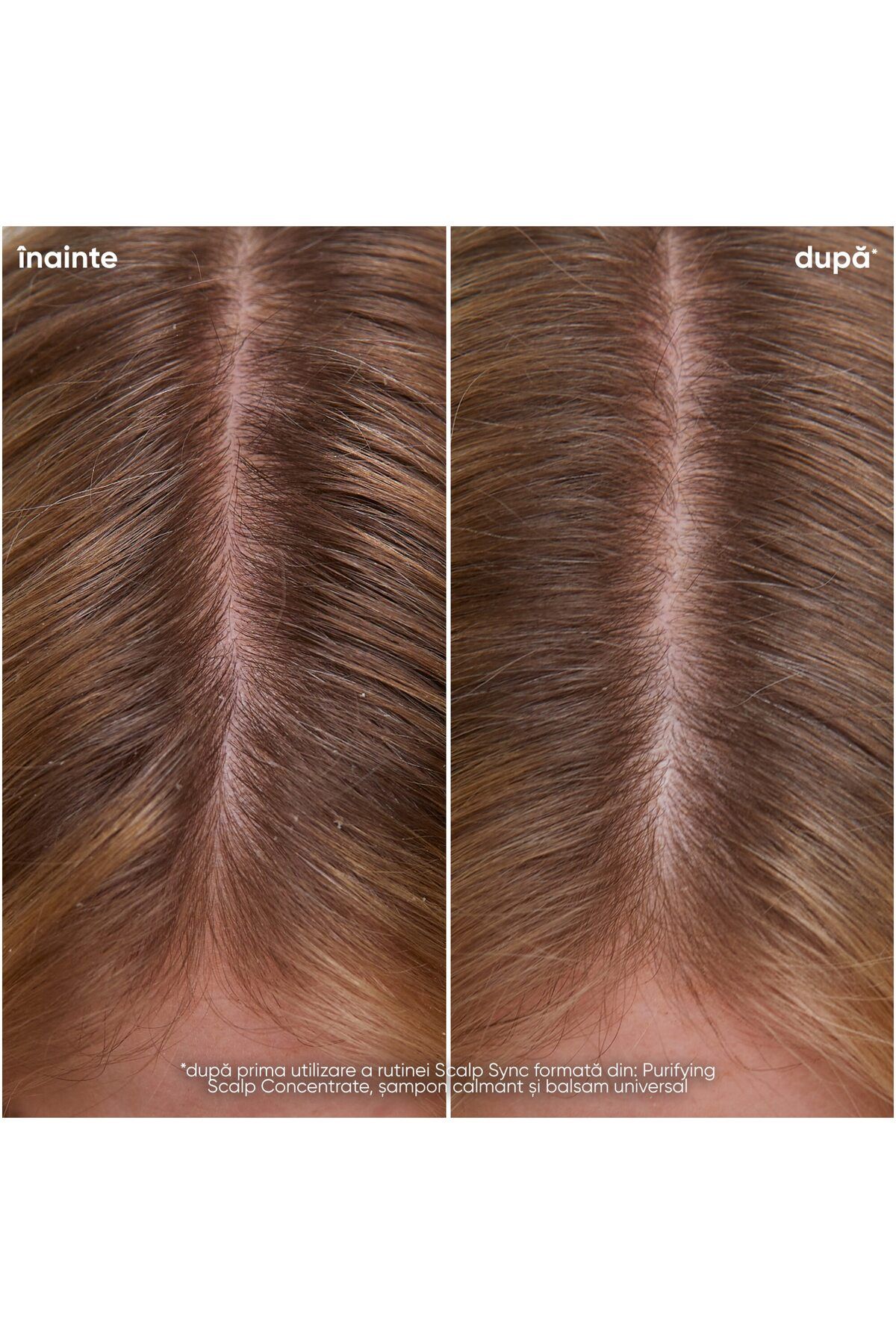 Biolage-Biolage Scalp Sync Soothing Shampoo with Glycolic Acid and Fermented Tea Extract 5