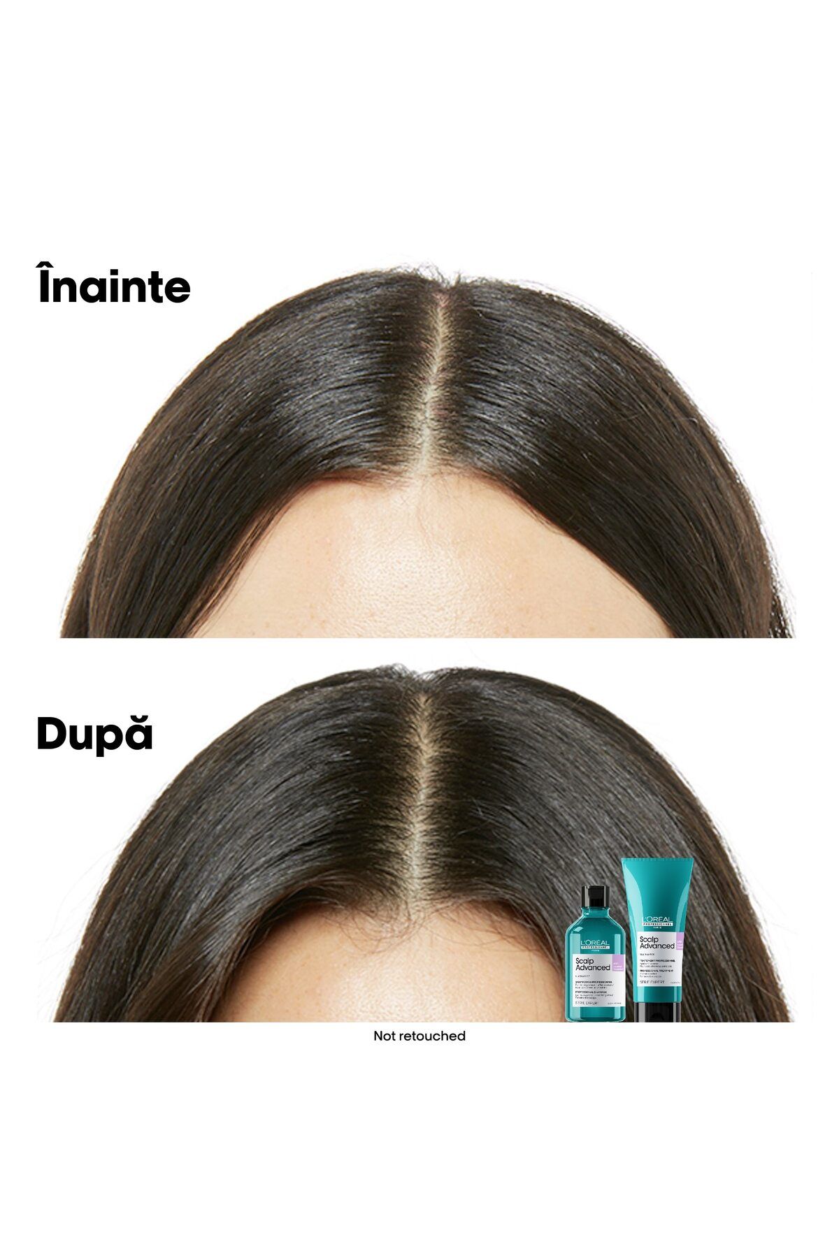 L'Oreal Paris-Sampon scalp sensibil 6