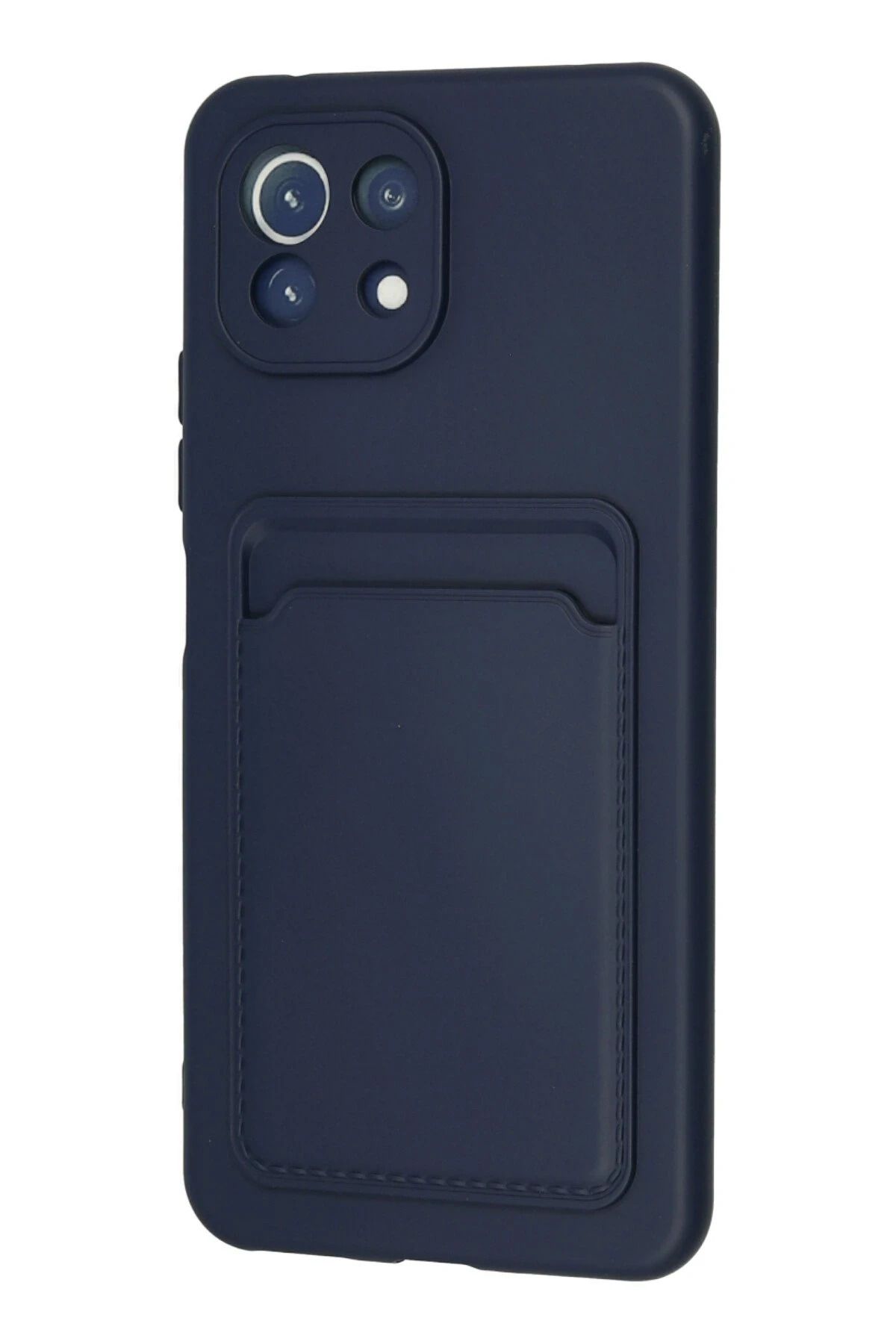 NewFace Xiaomi Mi 11 Kılıf Kelvin Kartvizitli Silikon - Lacivert SVLRS