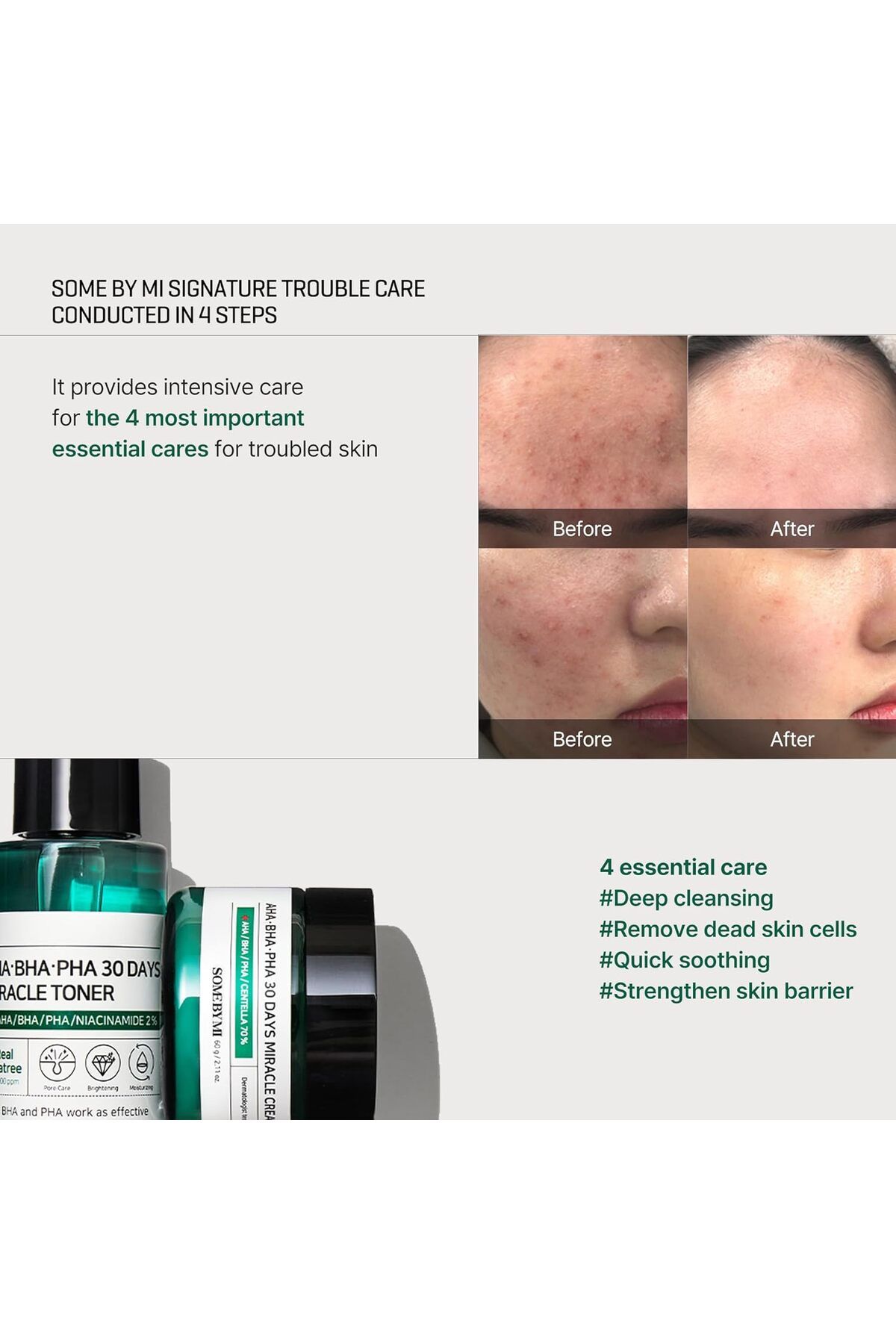 Some By Mi-30-Day Miracle Starter Skincare Set with AHA/BHA/PHA by Some By Mi (25g Soap + 30ml Toner + 10ml Ser 9