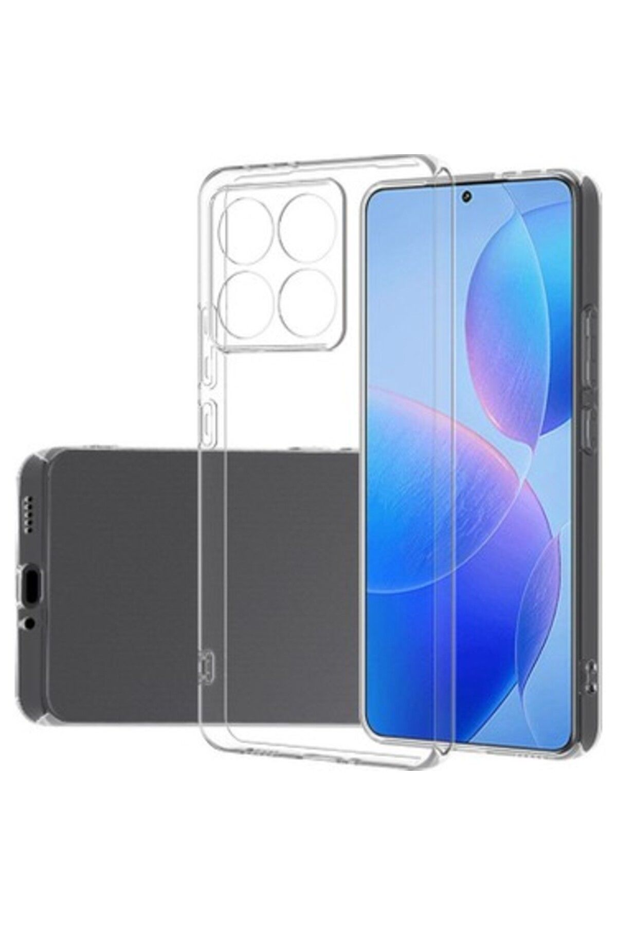 Di Aksesuar Şeffaf Lüx Kılıf Xiaomi Mi 14T Pro