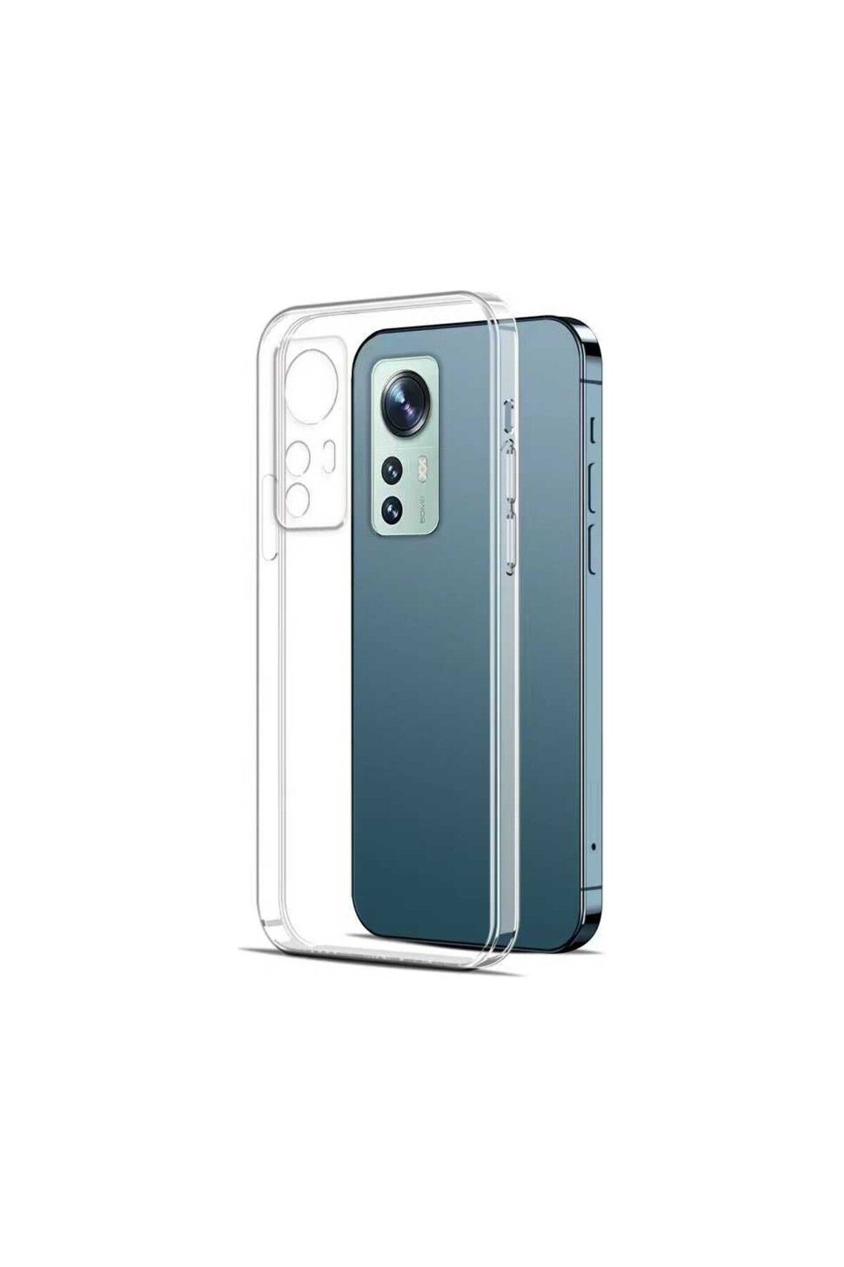 Di Aksesuar Şeffaf Lüx Kılıf Xiaomi Mi 12 Lite